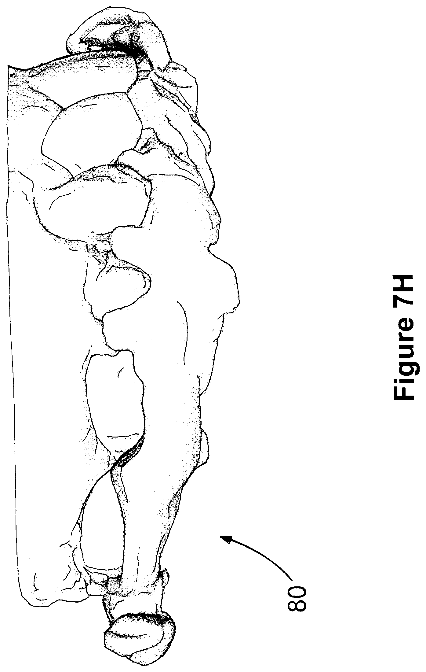 Patent US12426994 Figure 17 – Methods for generating dental models and appliances