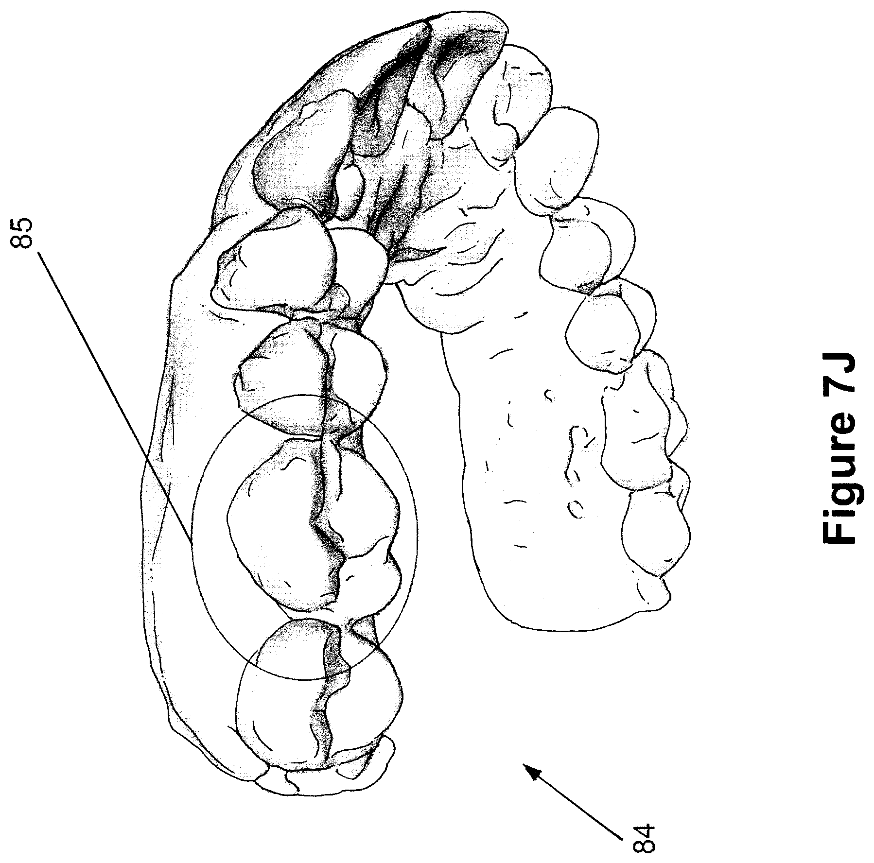 Patent US12426994 Figure 19 – Methods for generating dental models and appliances