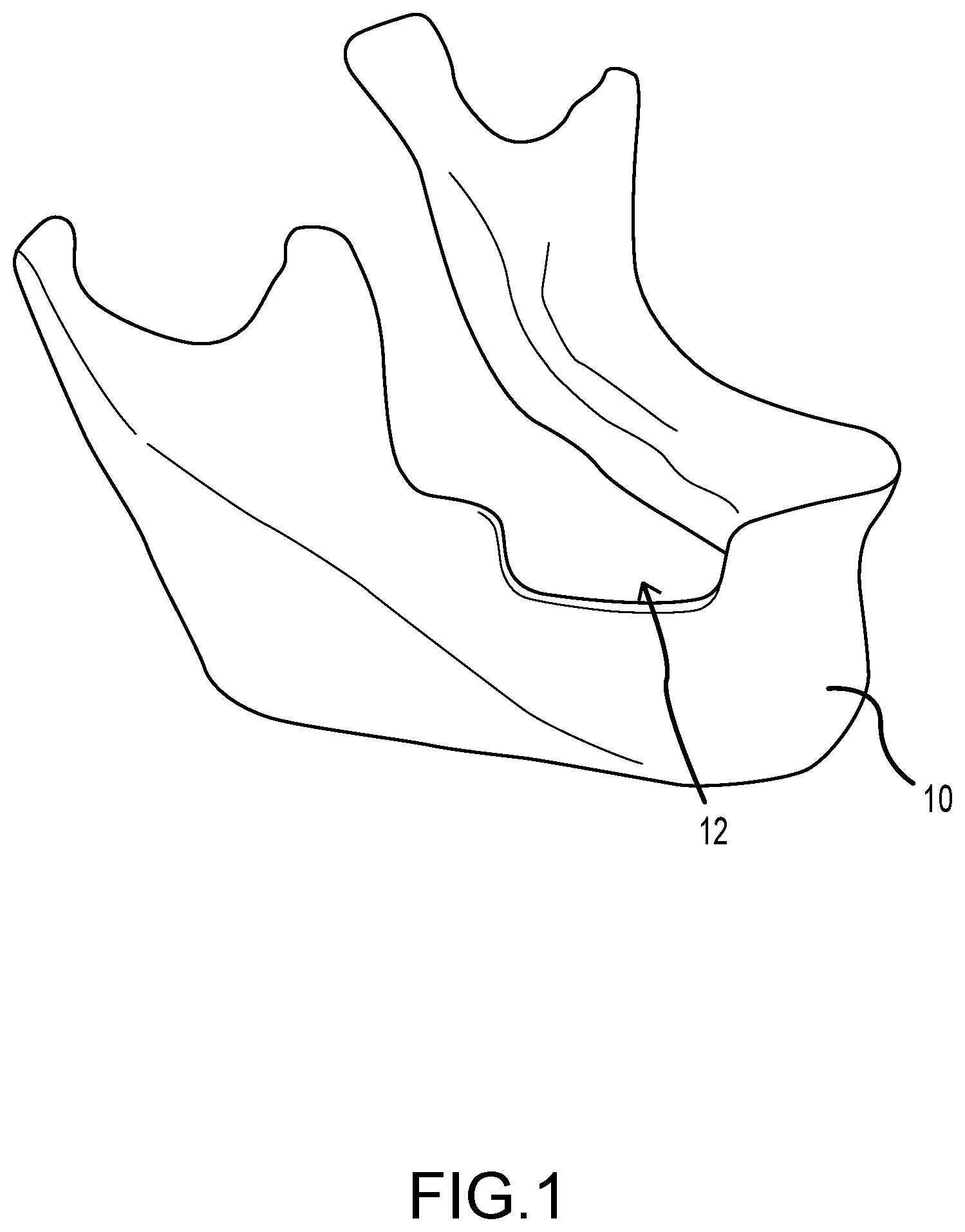 Patent US12426996 Figure 1 – Dental membrane