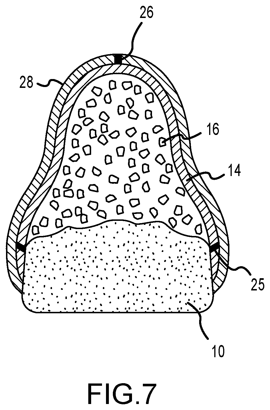 Patent US12426996 Figure 4 – Dental membrane