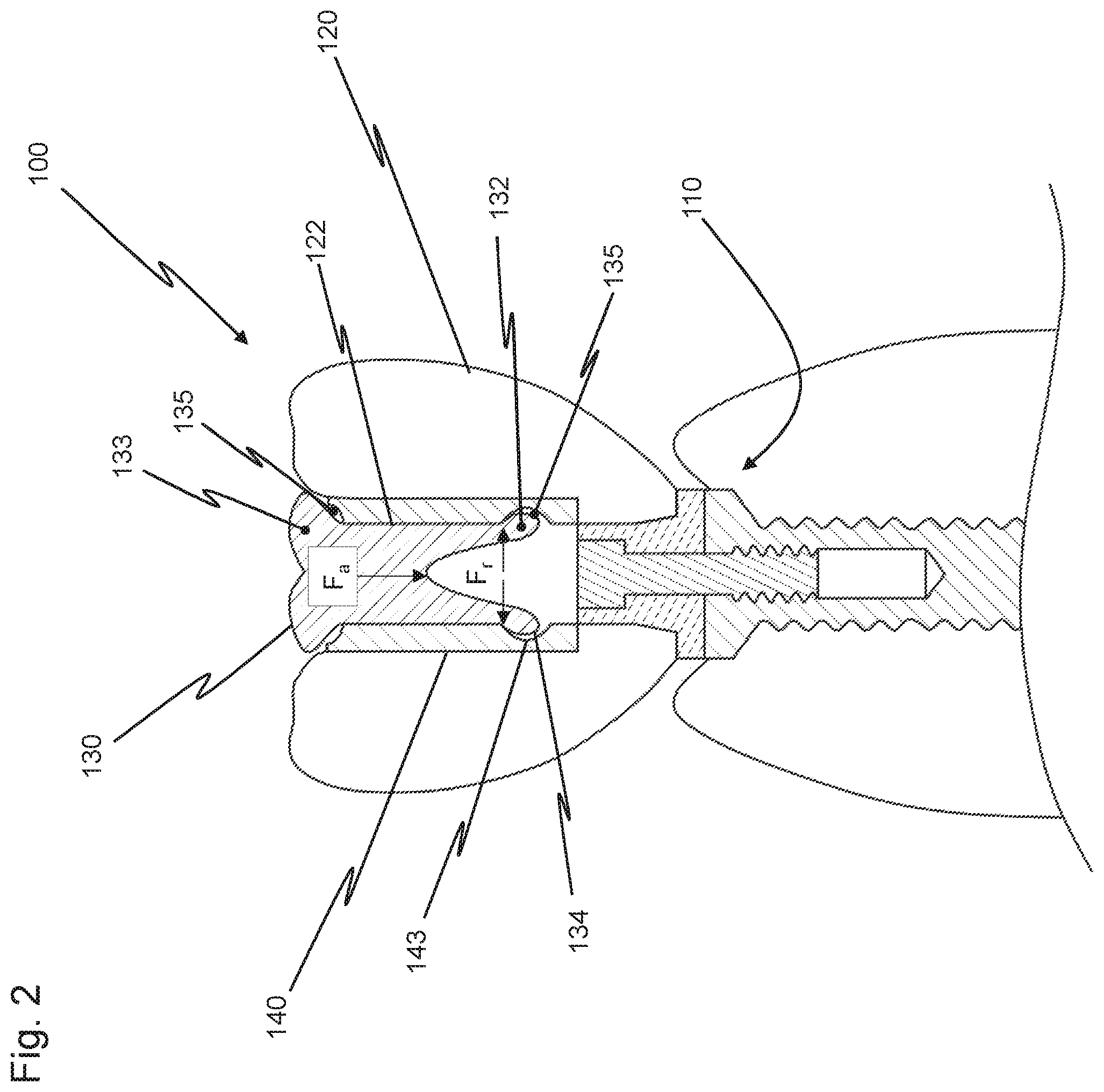 Patent US12426997 Figure 2 – Dental replacement having a connecting sleeve