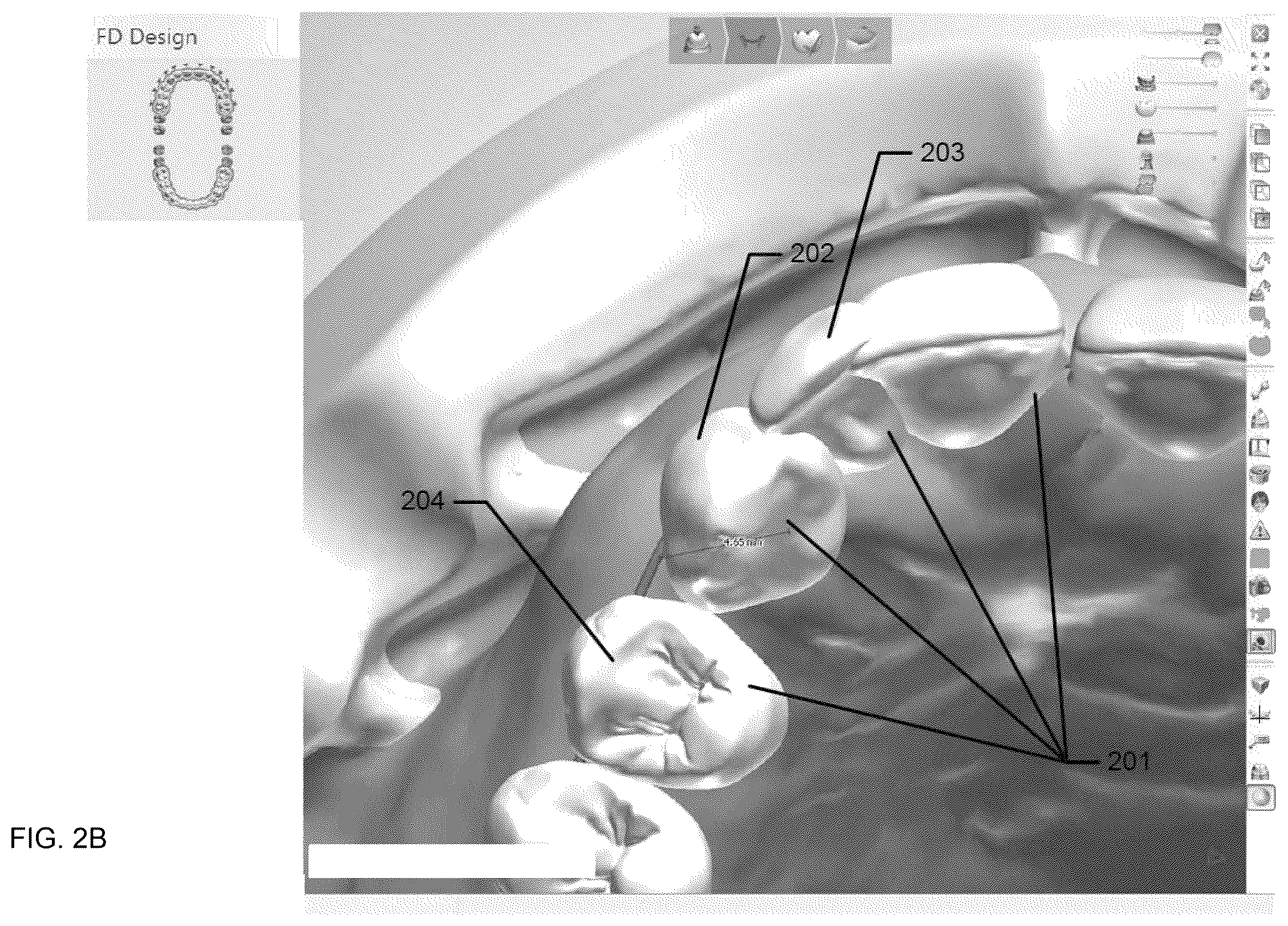 Patent US12426998 Figure 3 – Snapping of denture teeth