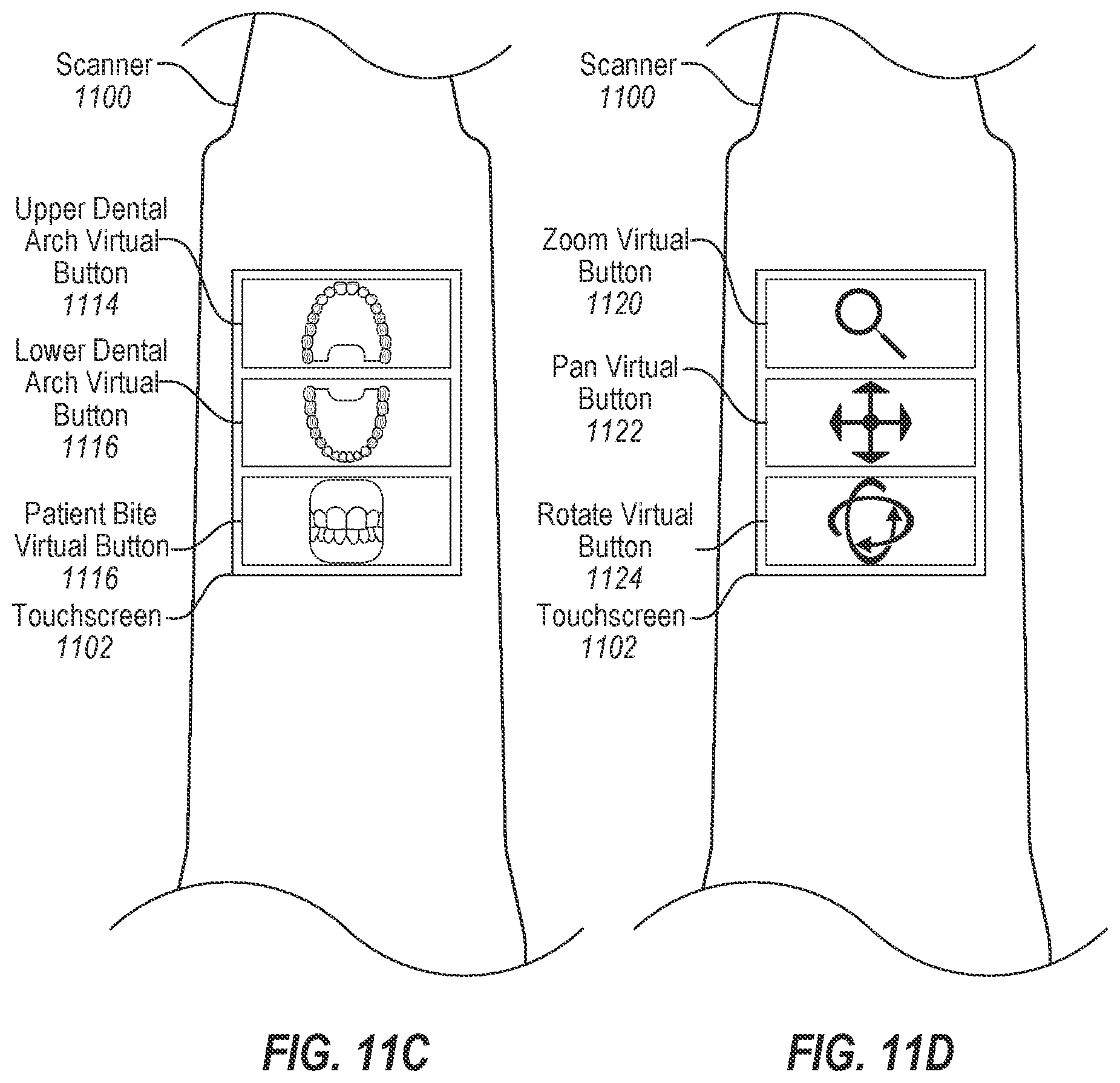 Patent US12426999 Figure 16 – Distributed intraoral scanning system