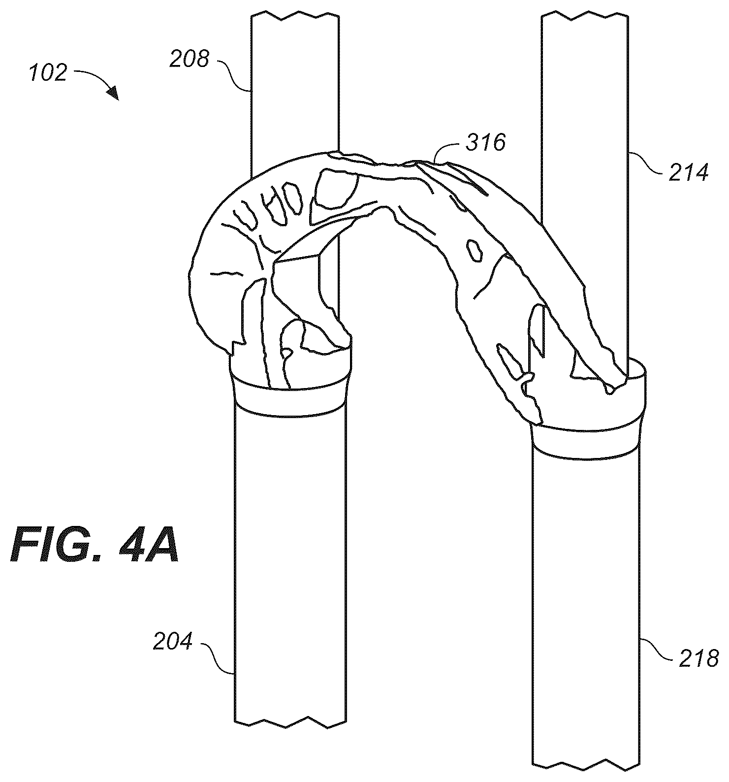 Patent US12437127 Figure 4 – Topologically optimized component design