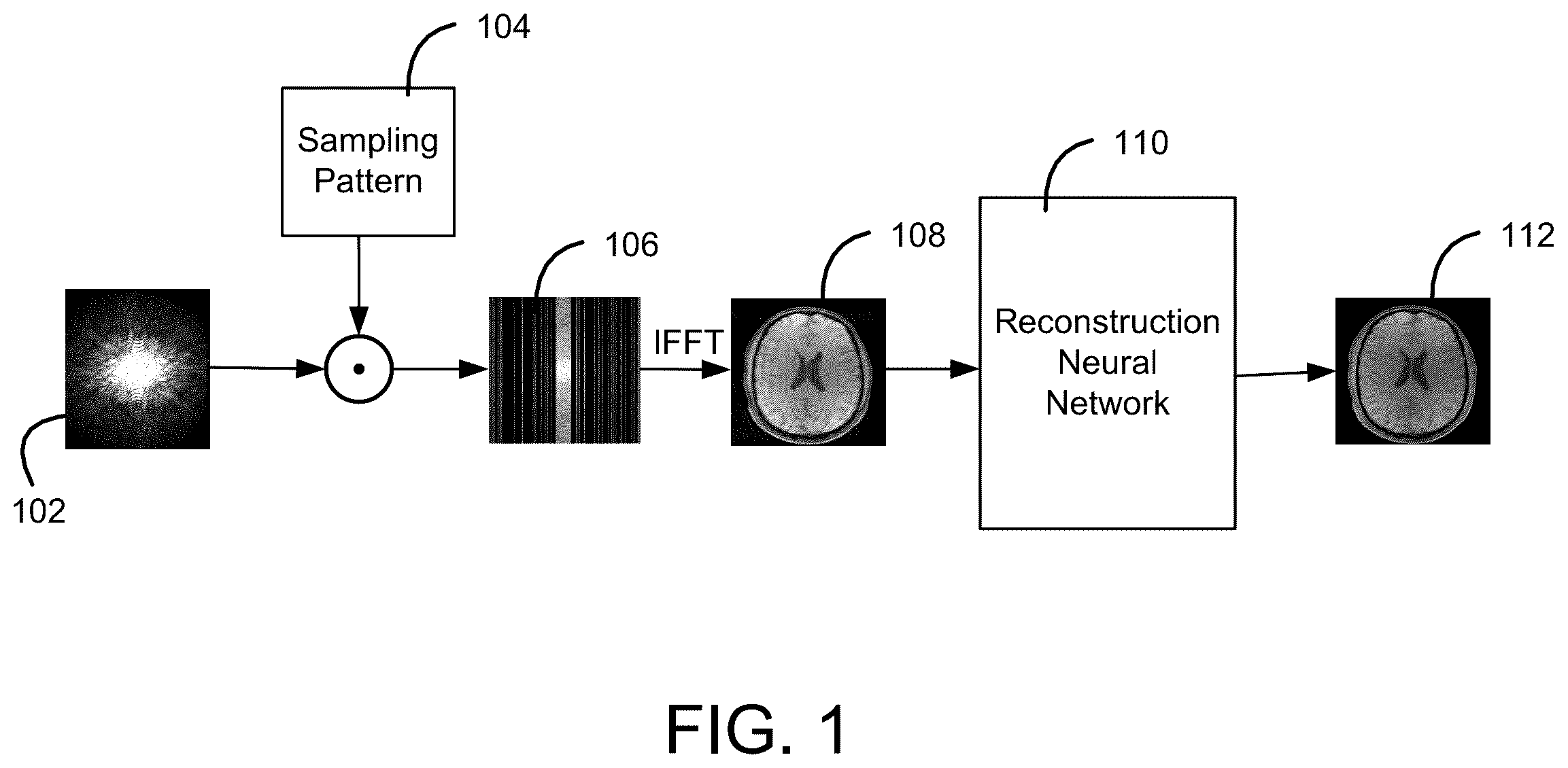 Patent US12437187 Figure 1 – MRI reconstruction based on generative models
