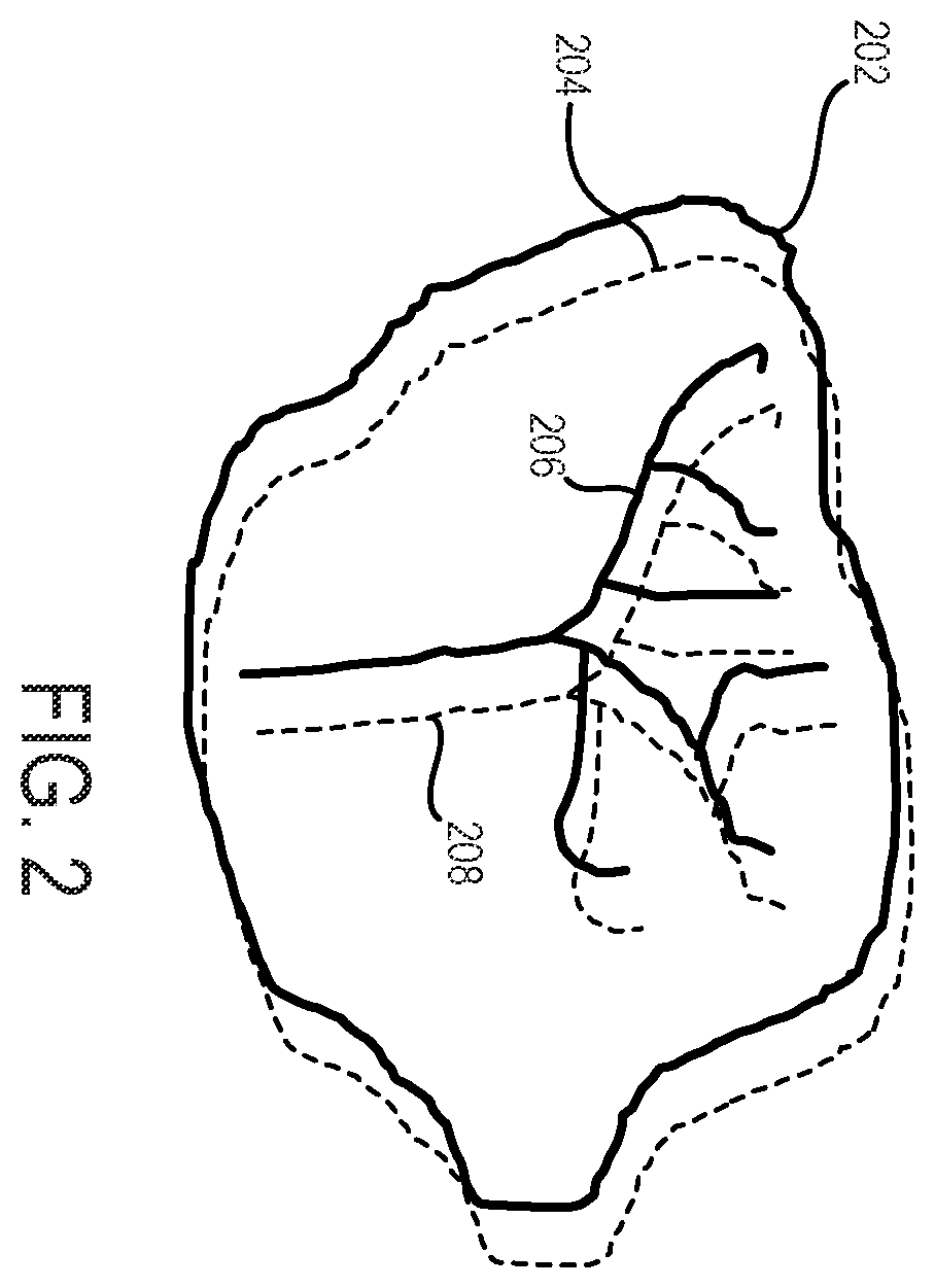 Patent US12437363 Figure 2 – Methods for high spatial and temporal resolution ultrasound imaging of microvessels