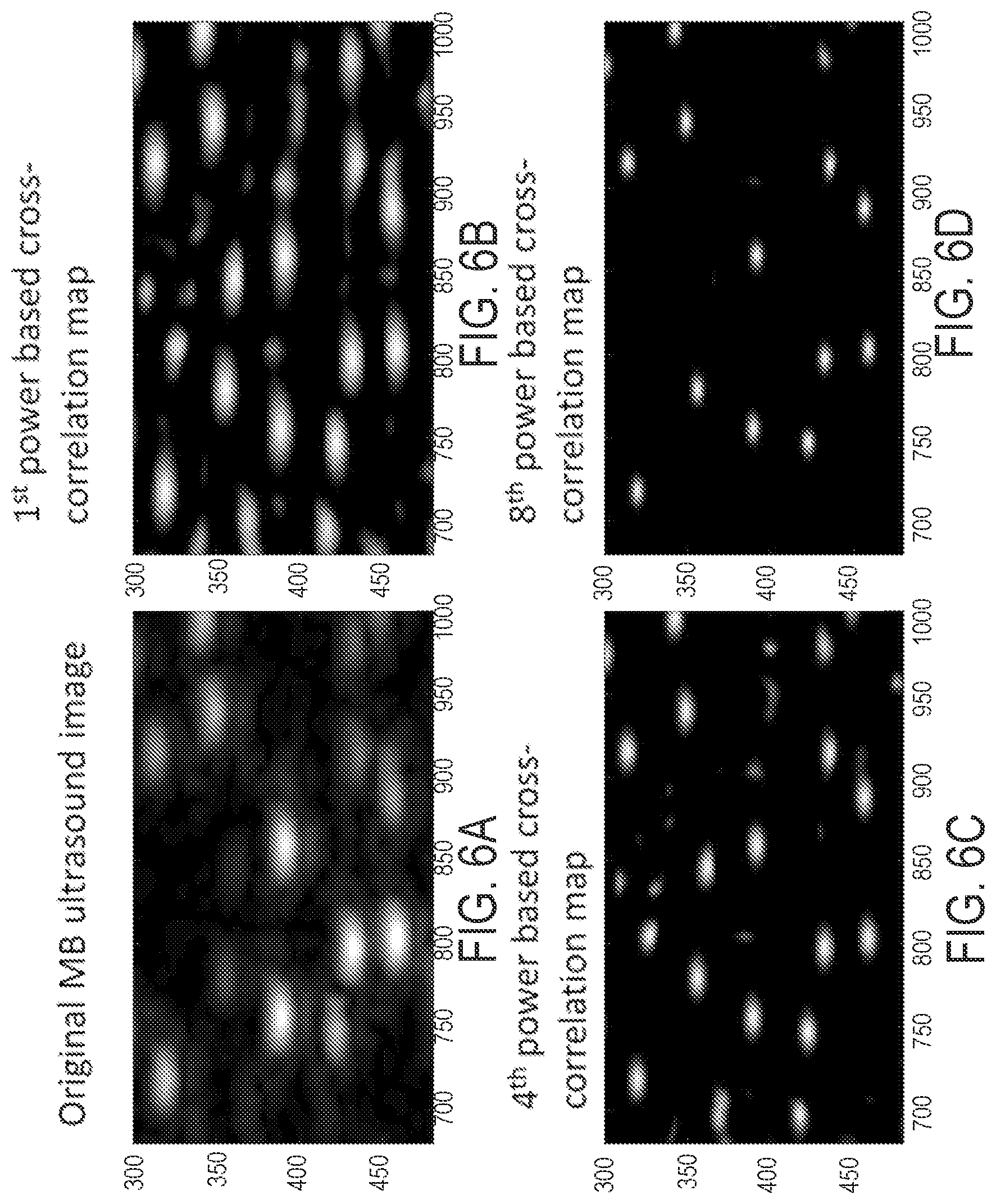Patent US12437363 Figure 6 – Methods for high spatial and temporal resolution ultrasound imaging of microvessels