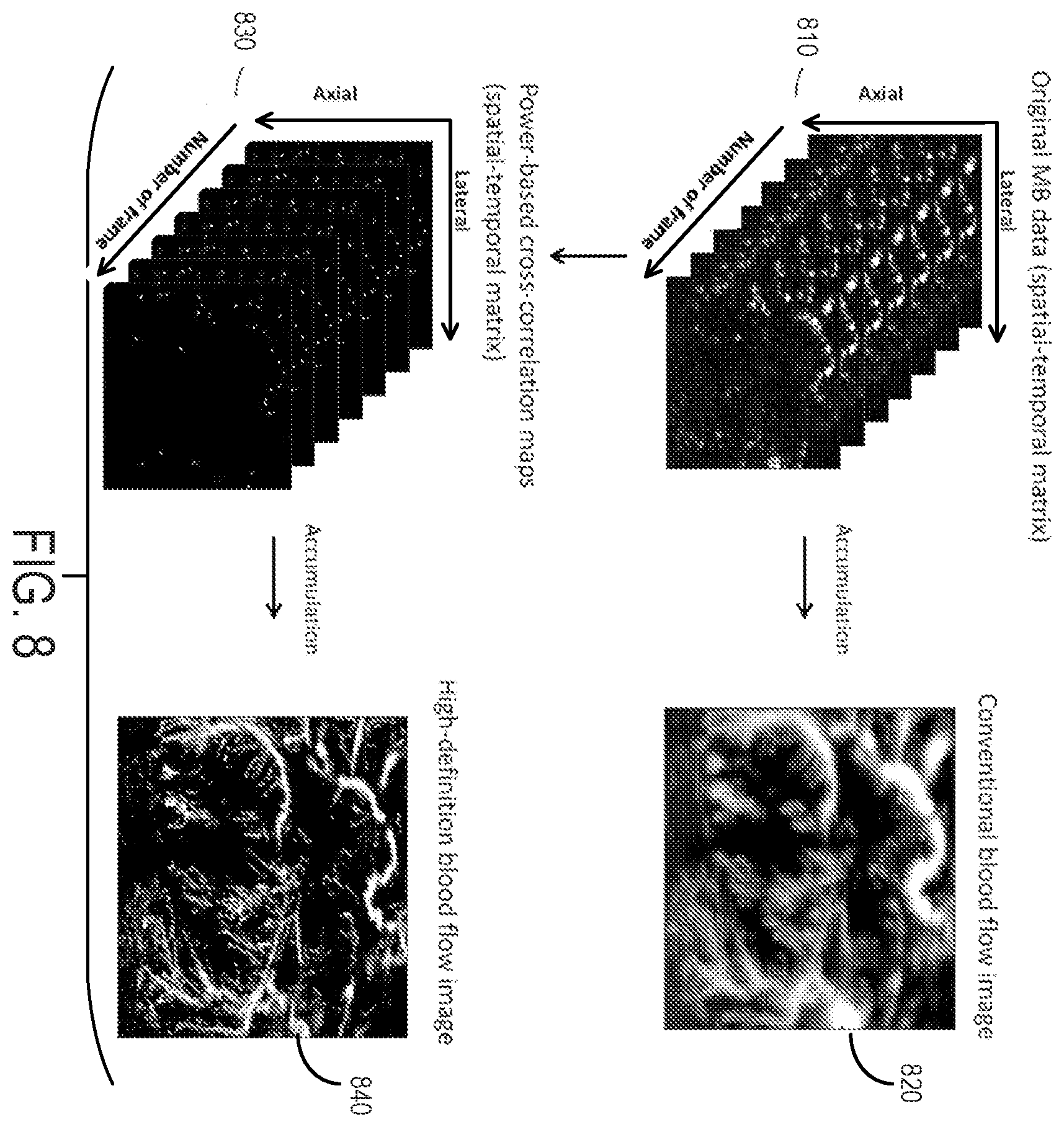 Patent US12437363 Figure 8 – Methods for high spatial and temporal resolution ultrasound imaging of microvessels