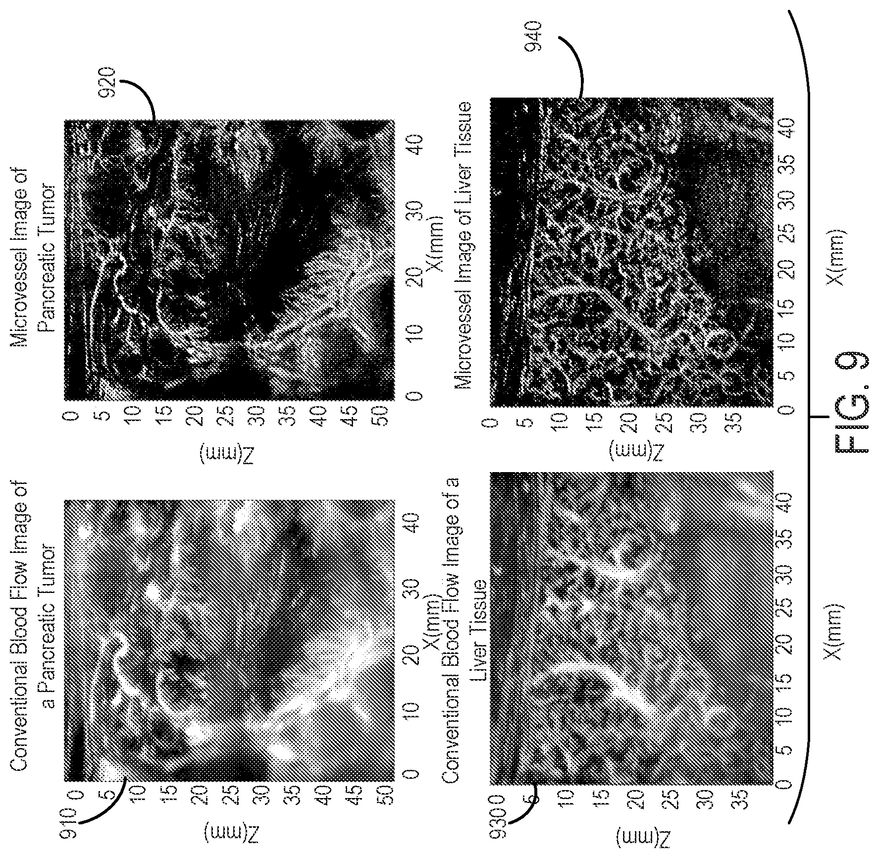 Patent US12437363 Figure 9 – Methods for high spatial and temporal resolution ultrasound imaging of microvessels