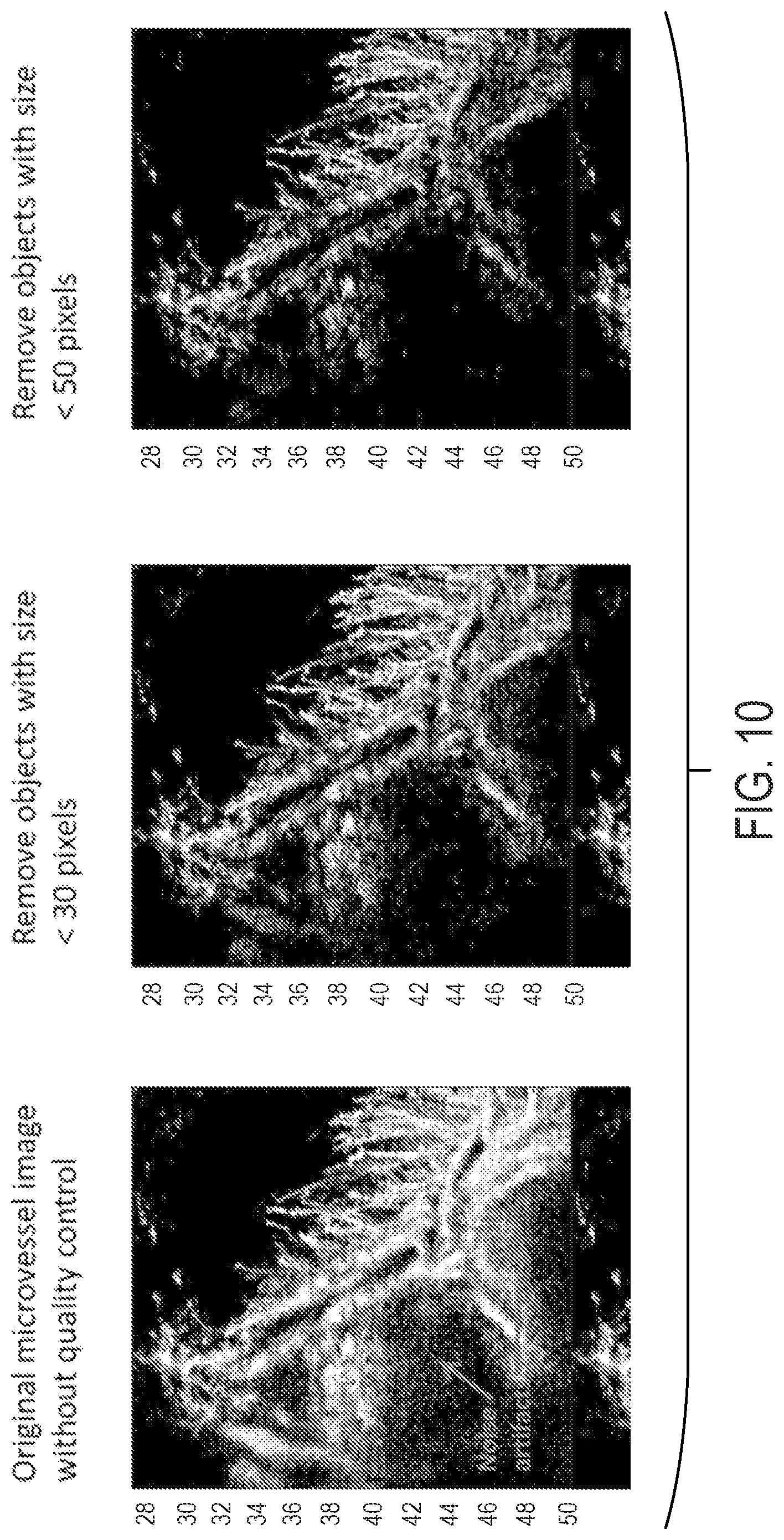 Patent US12437363 Figure 10 – Methods for high spatial and temporal resolution ultrasound imaging of microvessels