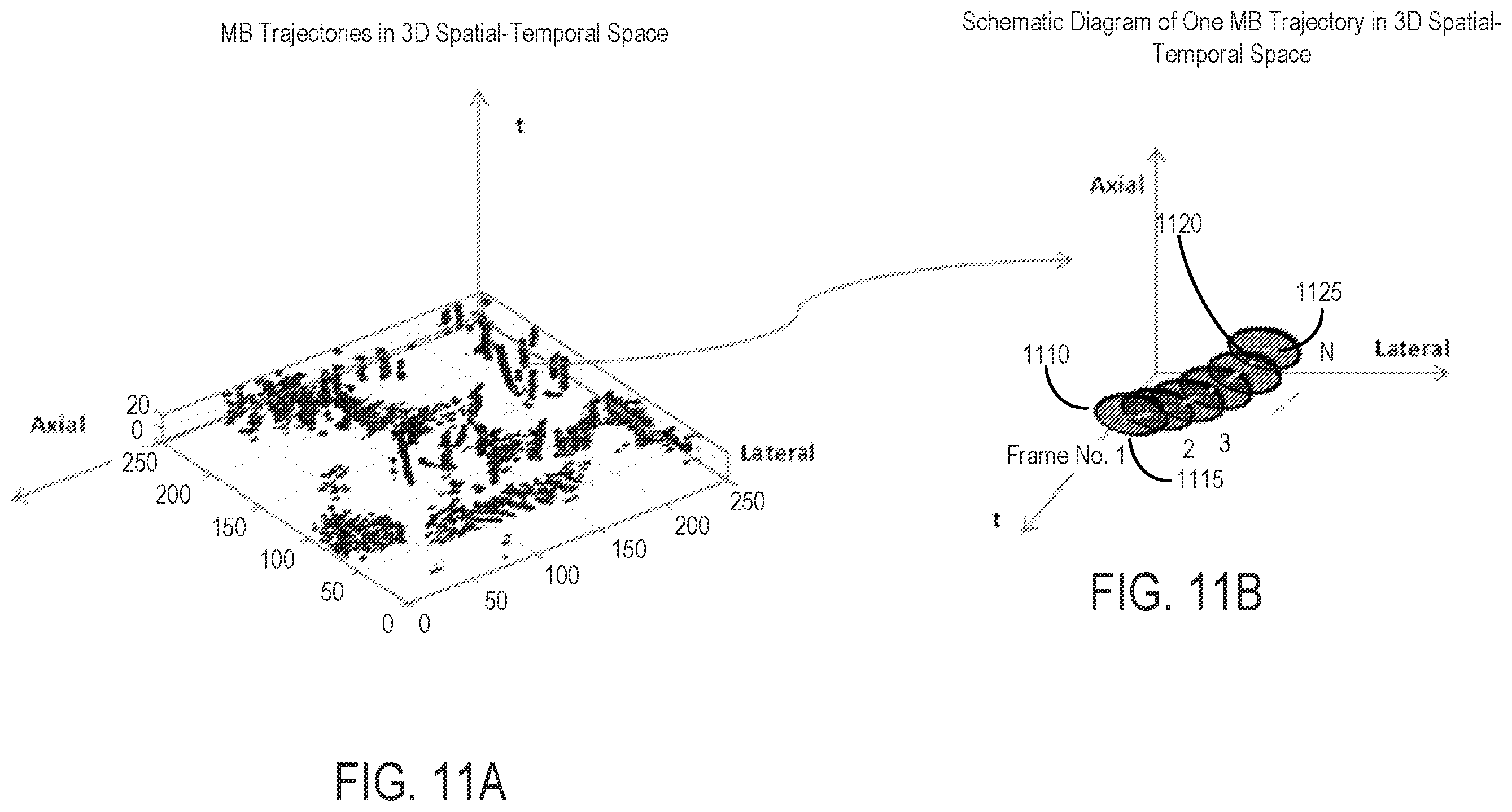 Patent US12437363 Figure 11 – Methods for high spatial and temporal resolution ultrasound imaging of microvessels