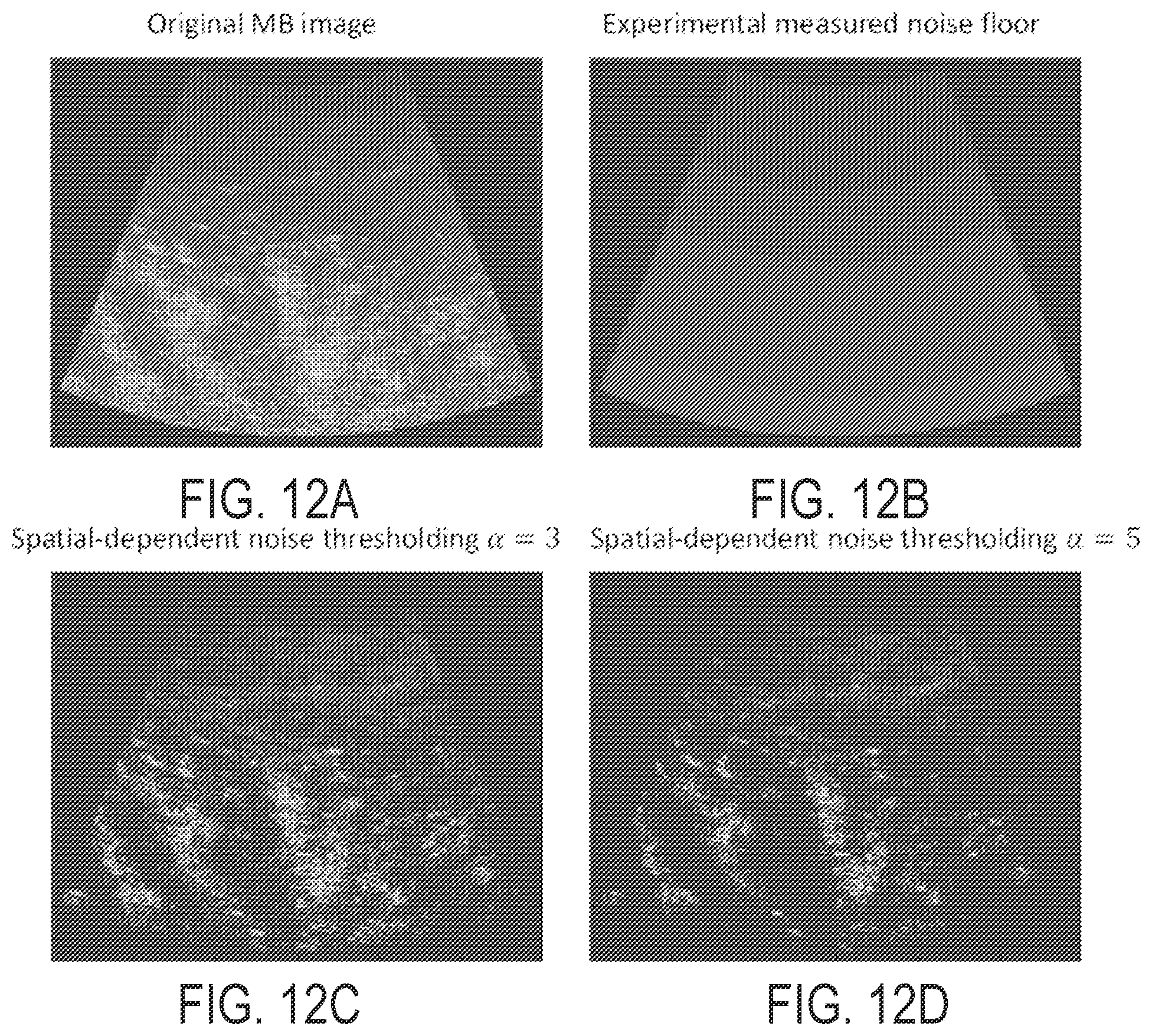 Patent US12437363 Figure 14 – Methods for high spatial and temporal resolution ultrasound imaging of microvessels