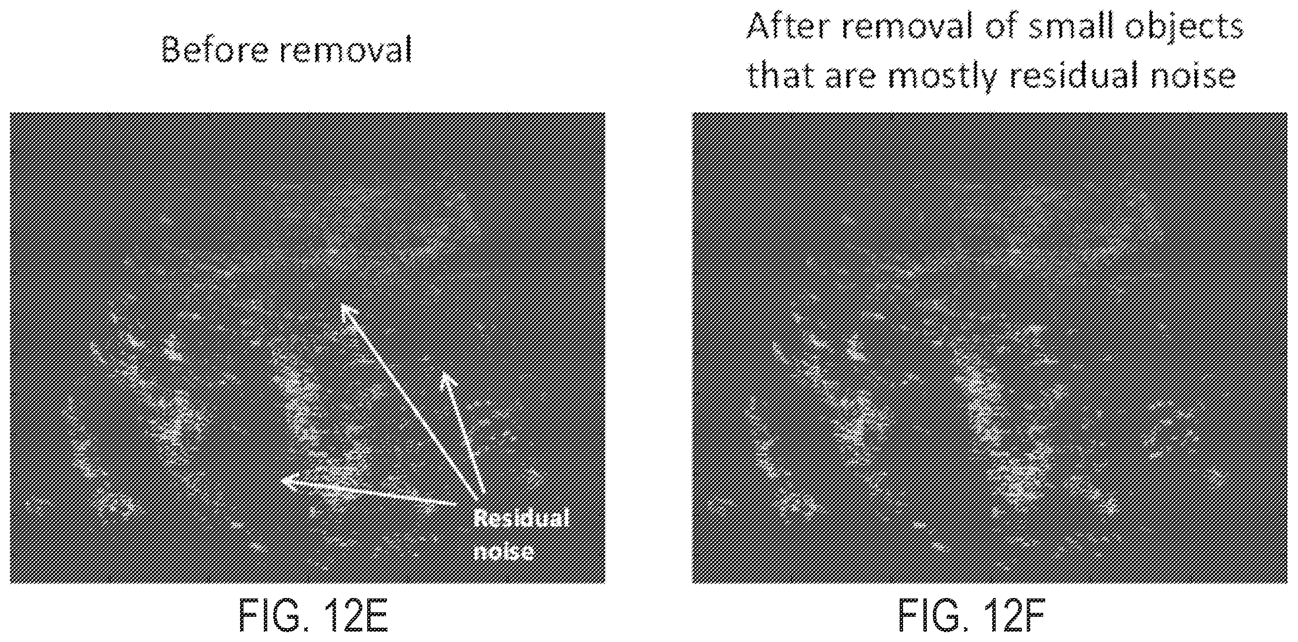 Patent US12437363 Figure 15 – Methods for high spatial and temporal resolution ultrasound imaging of microvessels