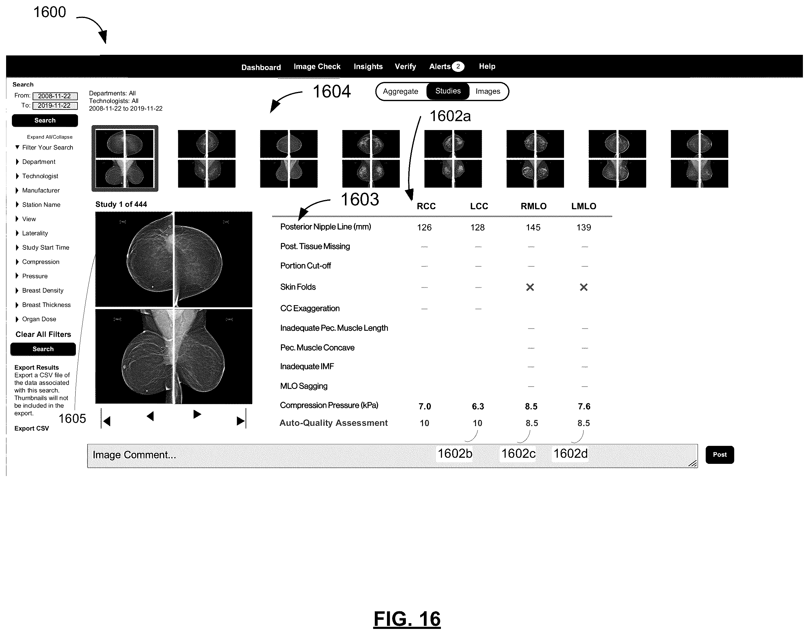 Patent US12437390 Figure 14 – System and method for assessing quality of medical images
