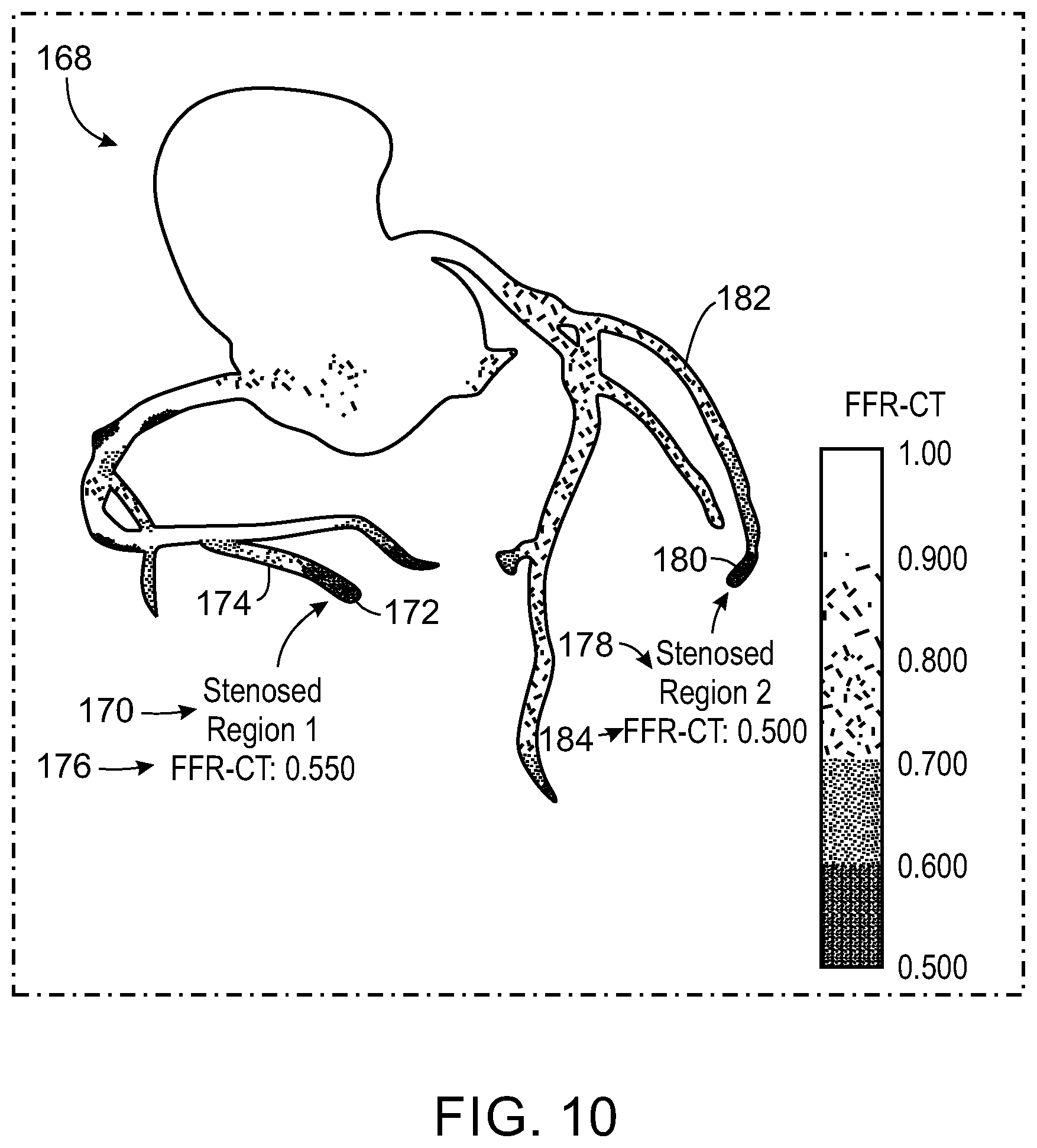 Patent US12437399 Figure 6 – System and method for location insensitive reporting of fractional flow reserve-computed tomography for a given stenosis