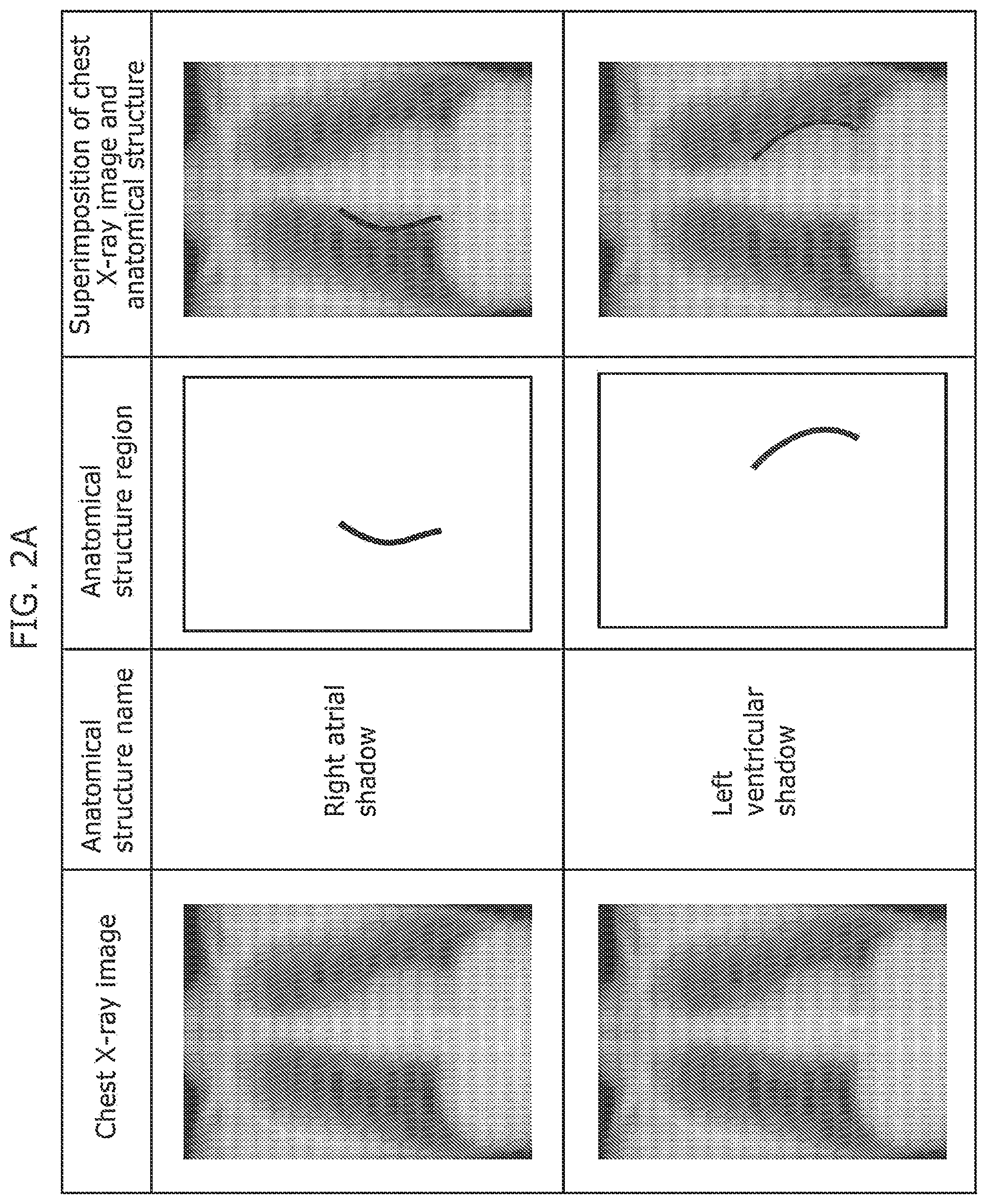 Patent US12437400 Figure 2 – Medical image abnormality detection system and abnormality detection method