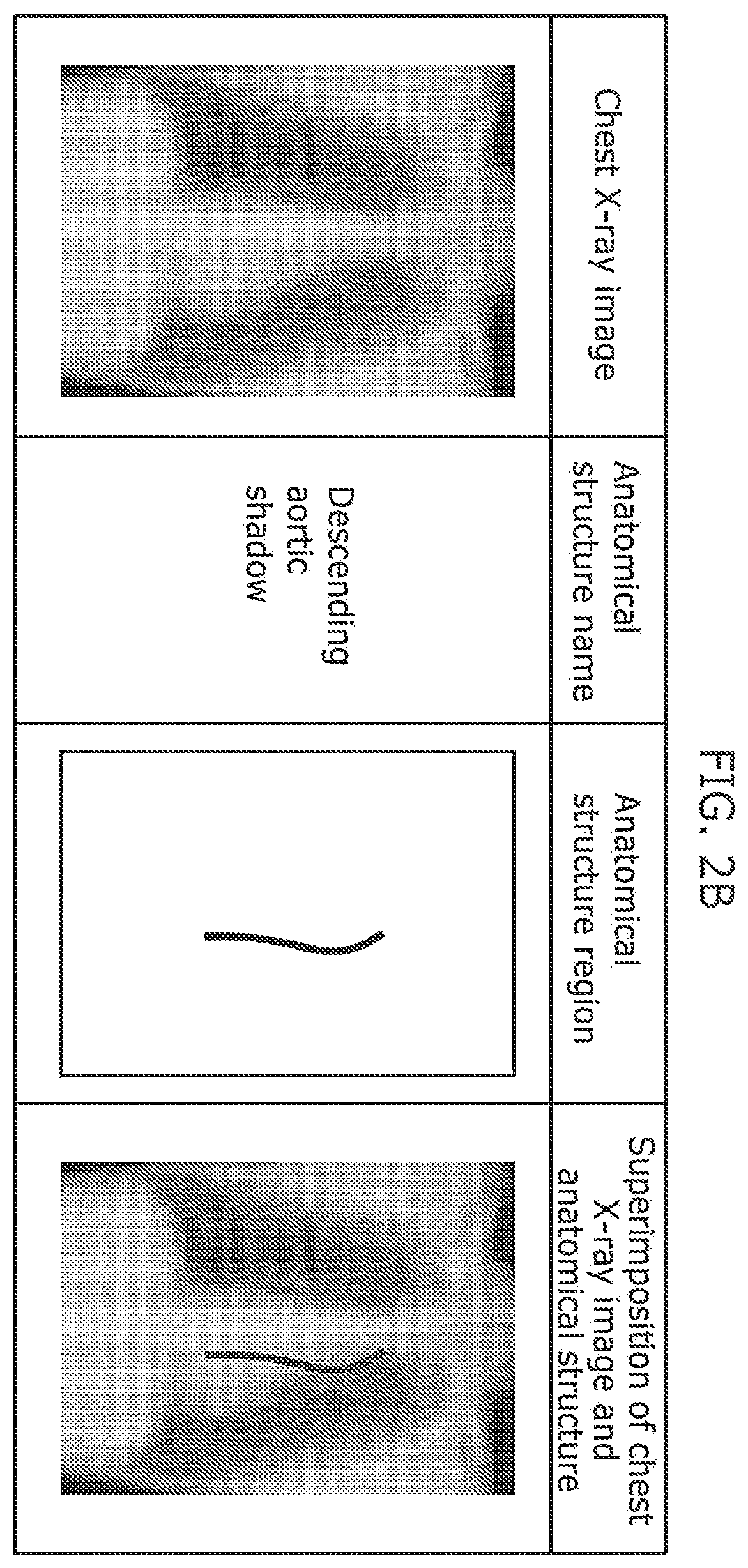 Patent US12437400 Figure 3 – Medical image abnormality detection system and abnormality detection method