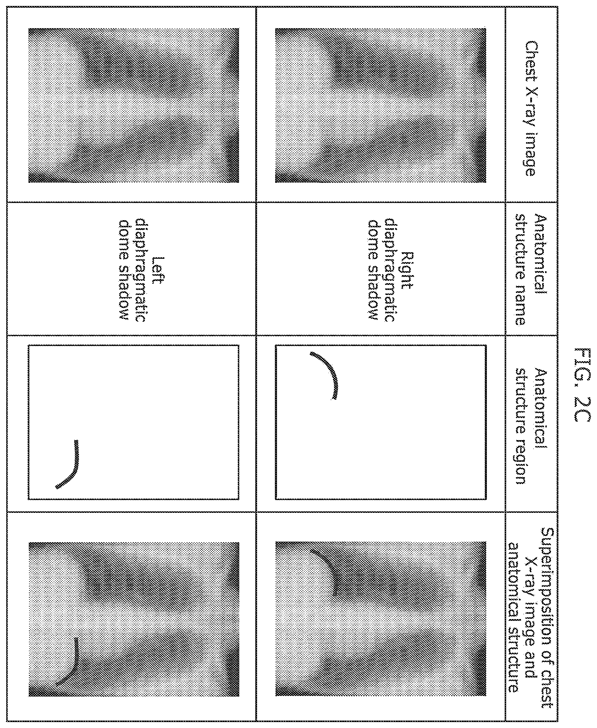 Patent US12437400 Figure 4 – Medical image abnormality detection system and abnormality detection method