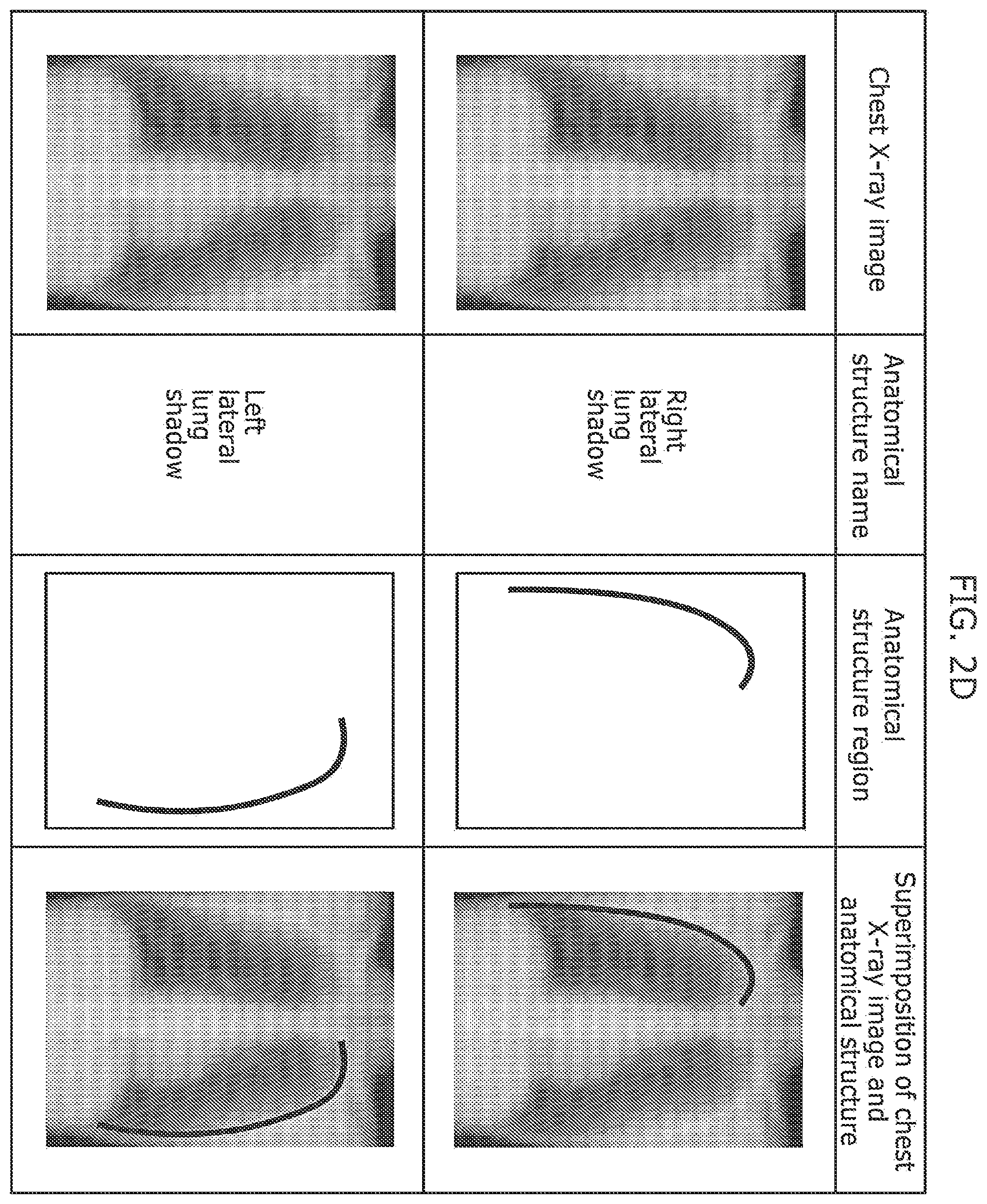 Patent US12437400 Figure 5 – Medical image abnormality detection system and abnormality detection method
