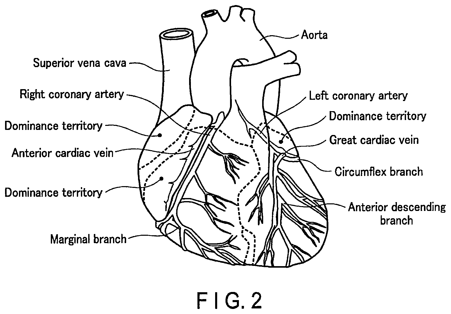 Patent US12437405 Figure 2 – Medical image processing apparatus and medical image processing method