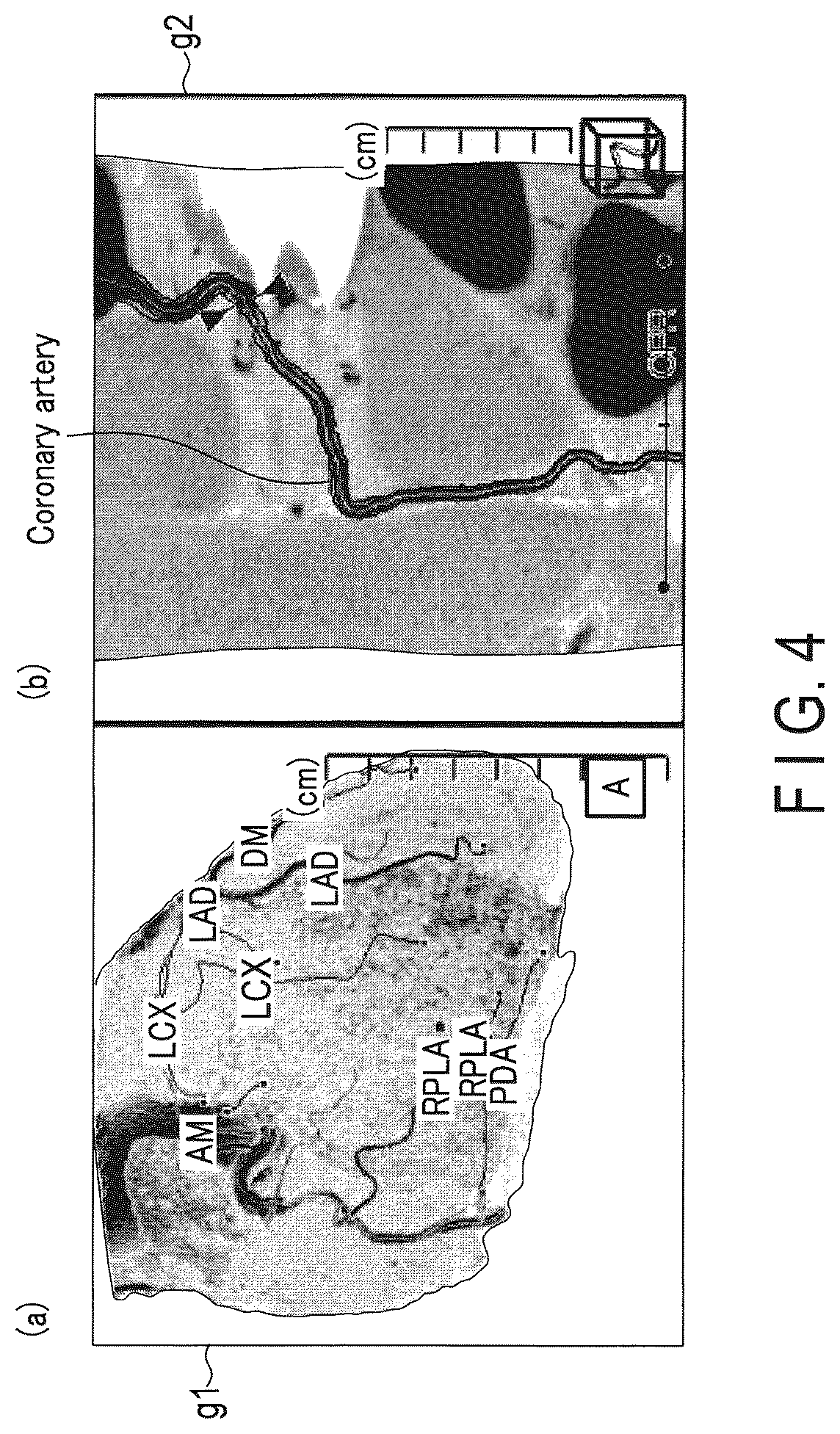 Patent US12437405 Figure 4 – Medical image processing apparatus and medical image processing method