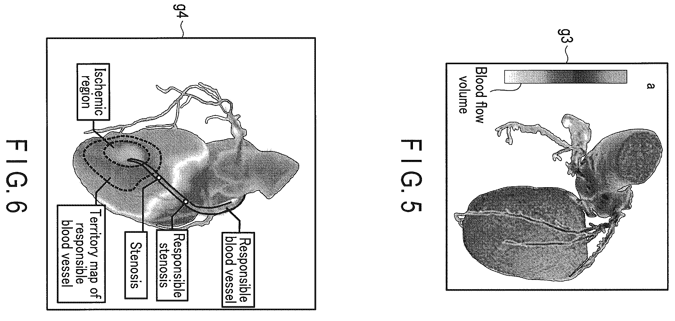 Patent US12437405 Figure 5 – Medical image processing apparatus and medical image processing method