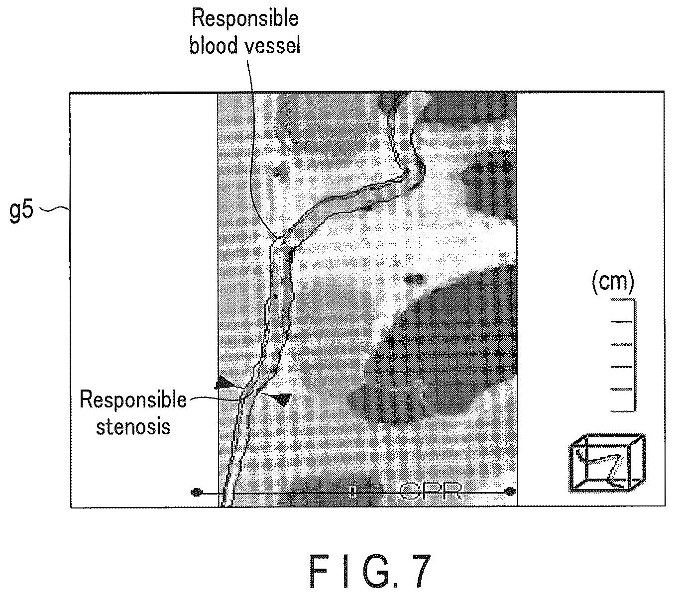 Patent US12437405 Figure 6 – Medical image processing apparatus and medical image processing method