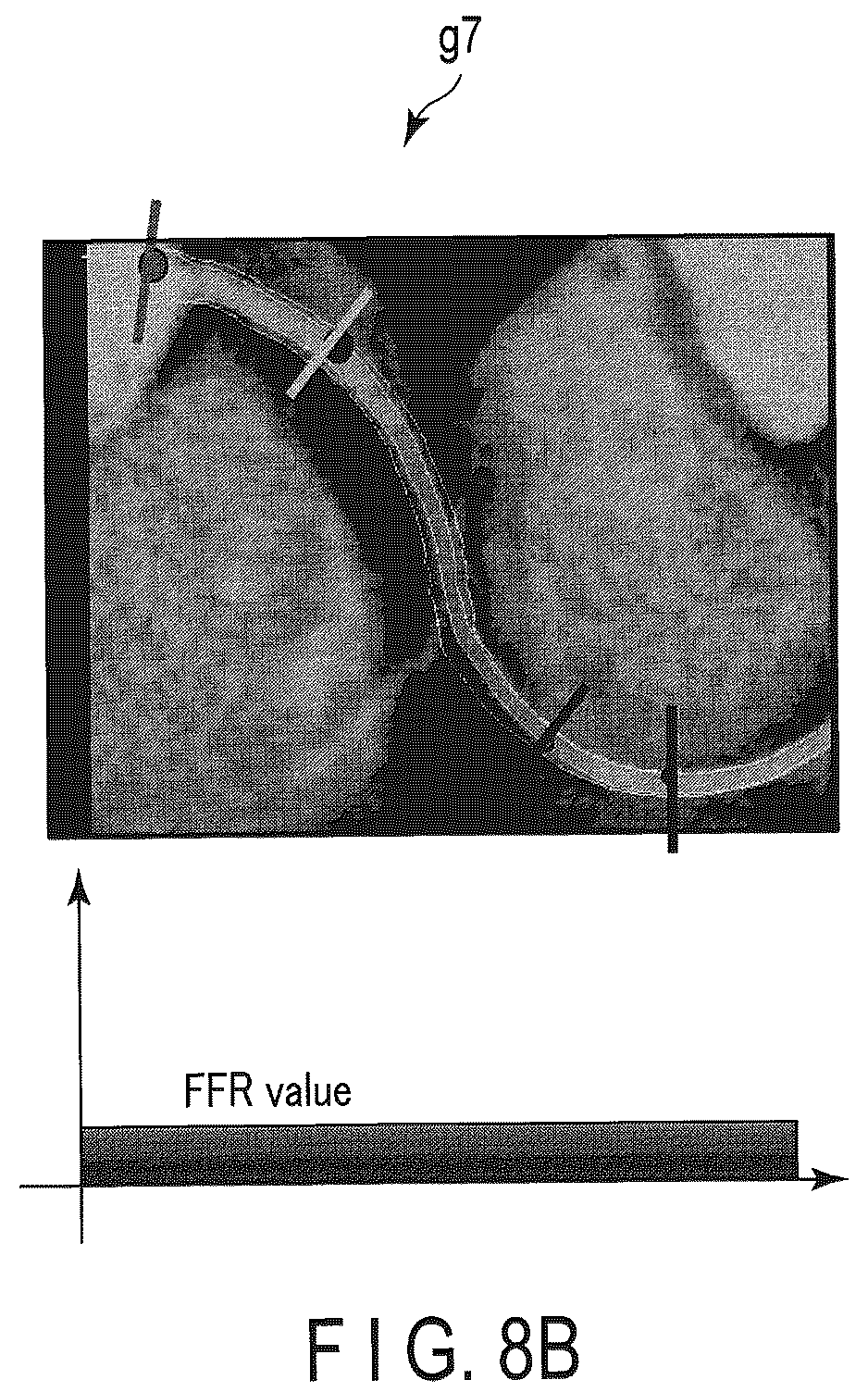 Patent US12437405 Figure 8 – Medical image processing apparatus and medical image processing method