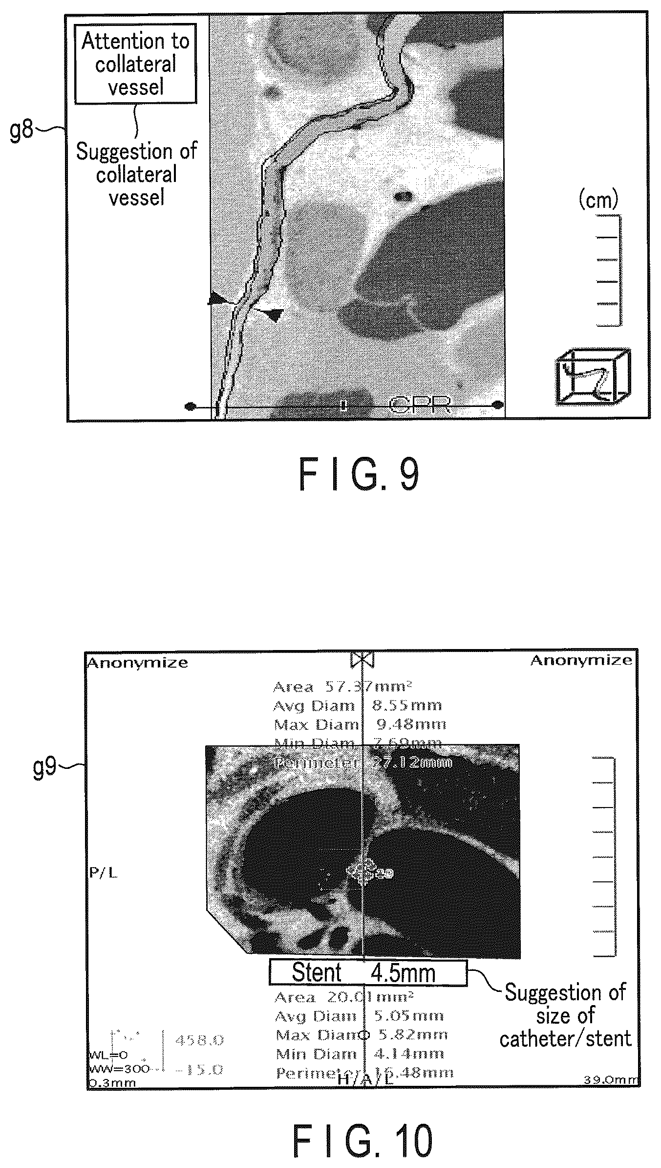 Patent US12437405 Figure 9 – Medical image processing apparatus and medical image processing method