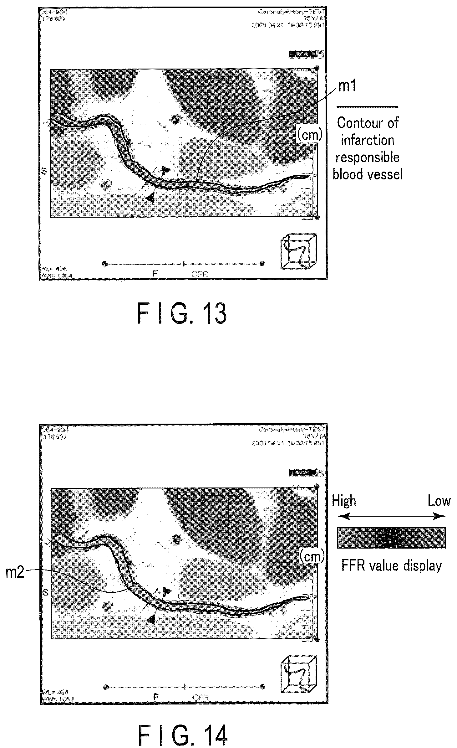 Patent US12437405 Figure 12 – Medical image processing apparatus and medical image processing method