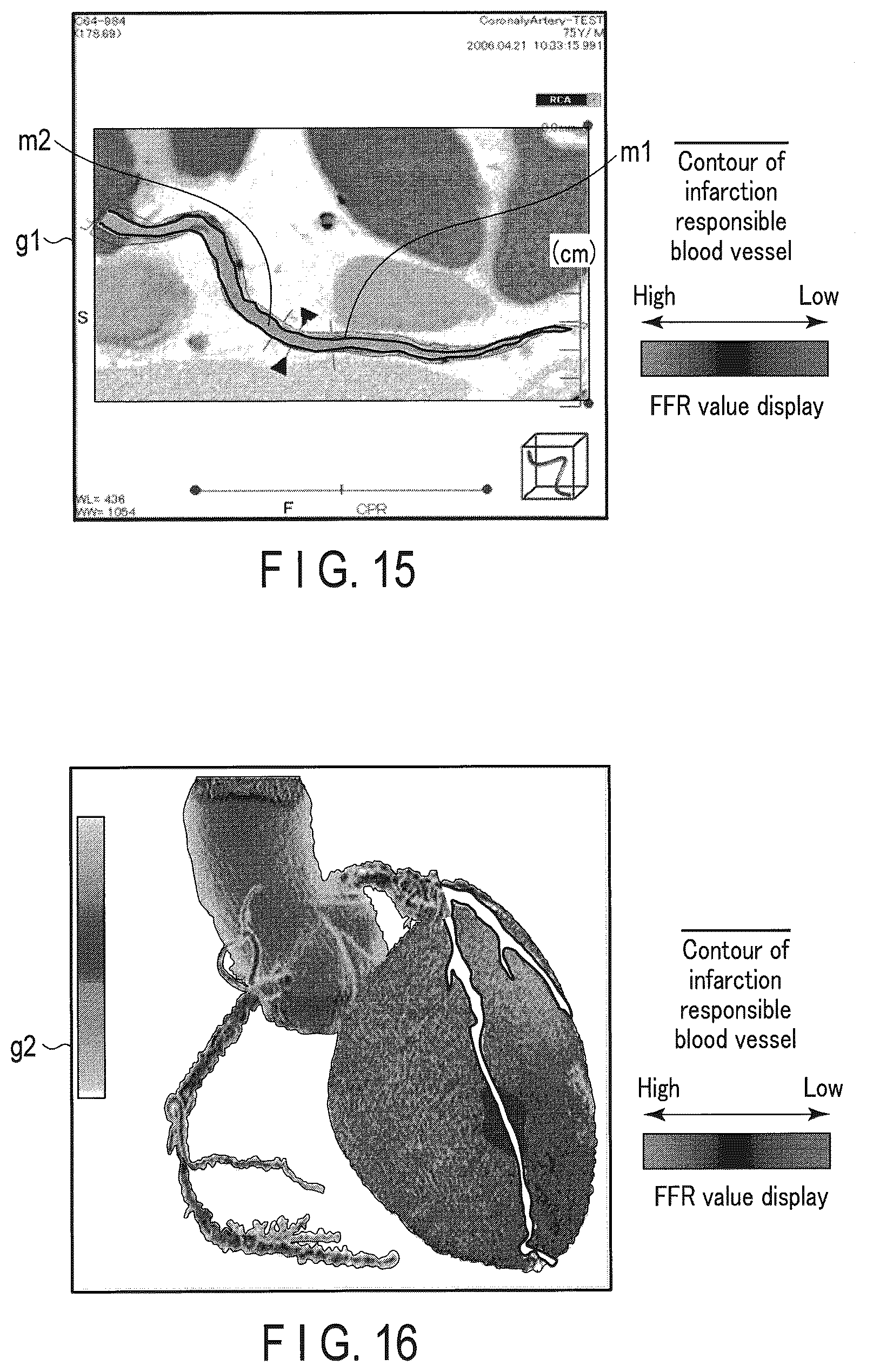 Patent US12437405 Figure 13 – Medical image processing apparatus and medical image processing method