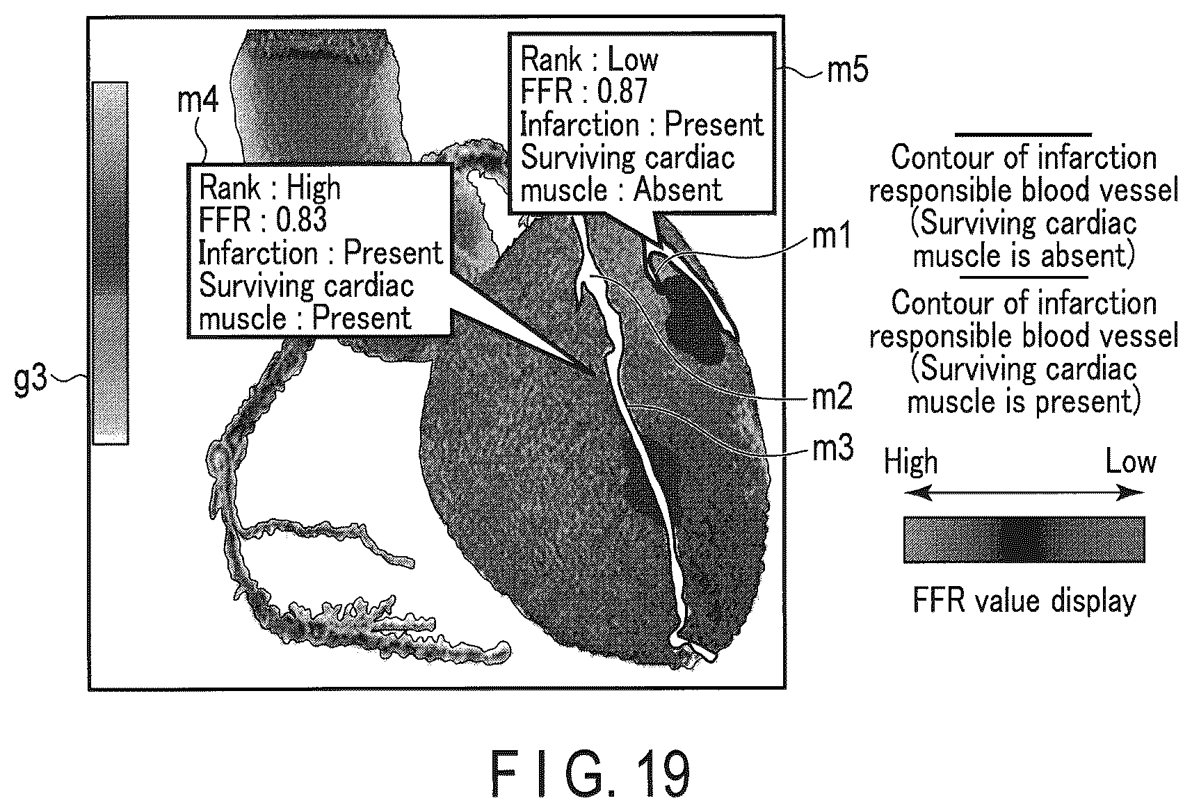 Patent US12437405 Figure 16 – Medical image processing apparatus and medical image processing method