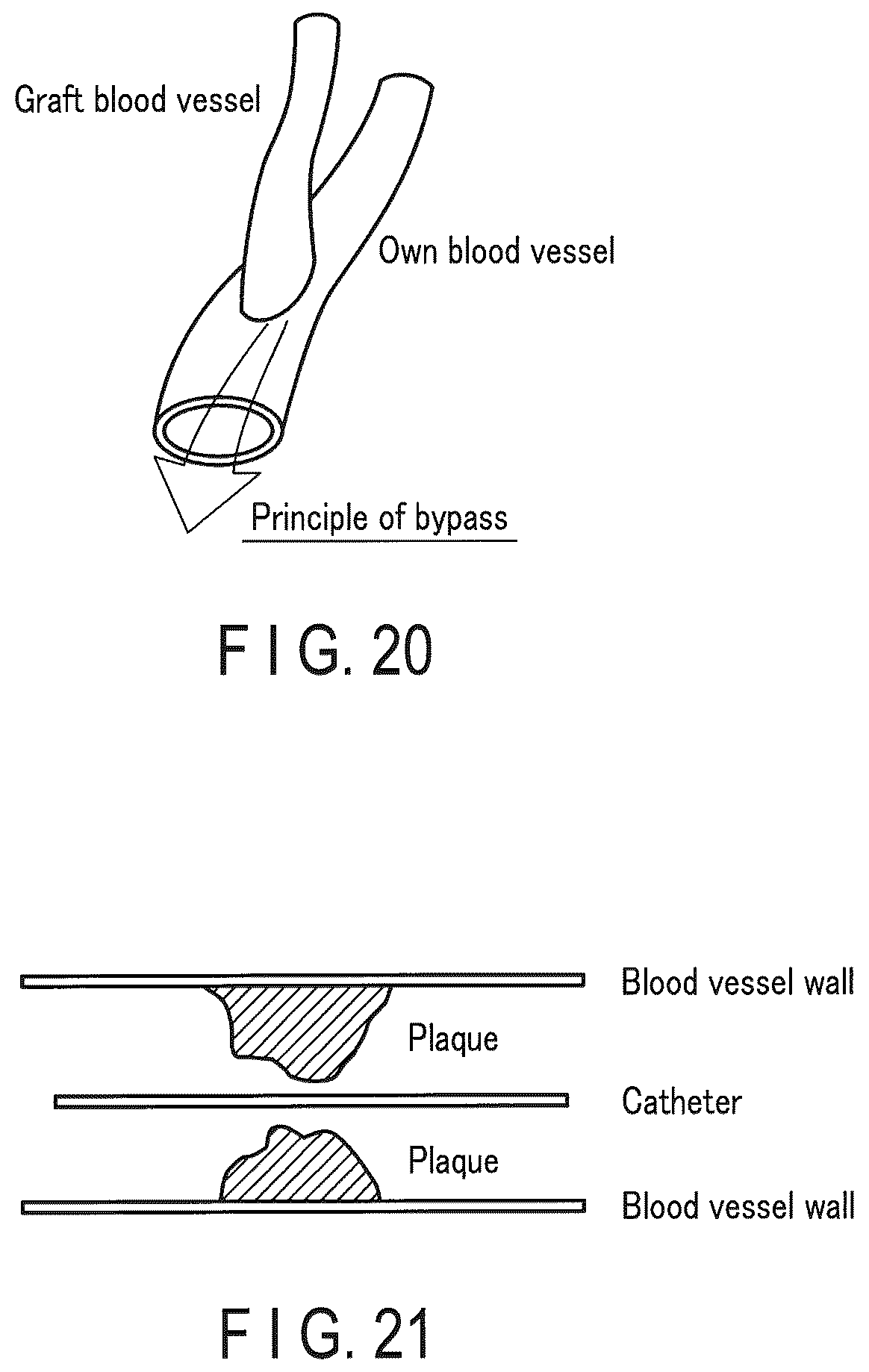 Patent US12437405 Figure 17 – Medical image processing apparatus and medical image processing method