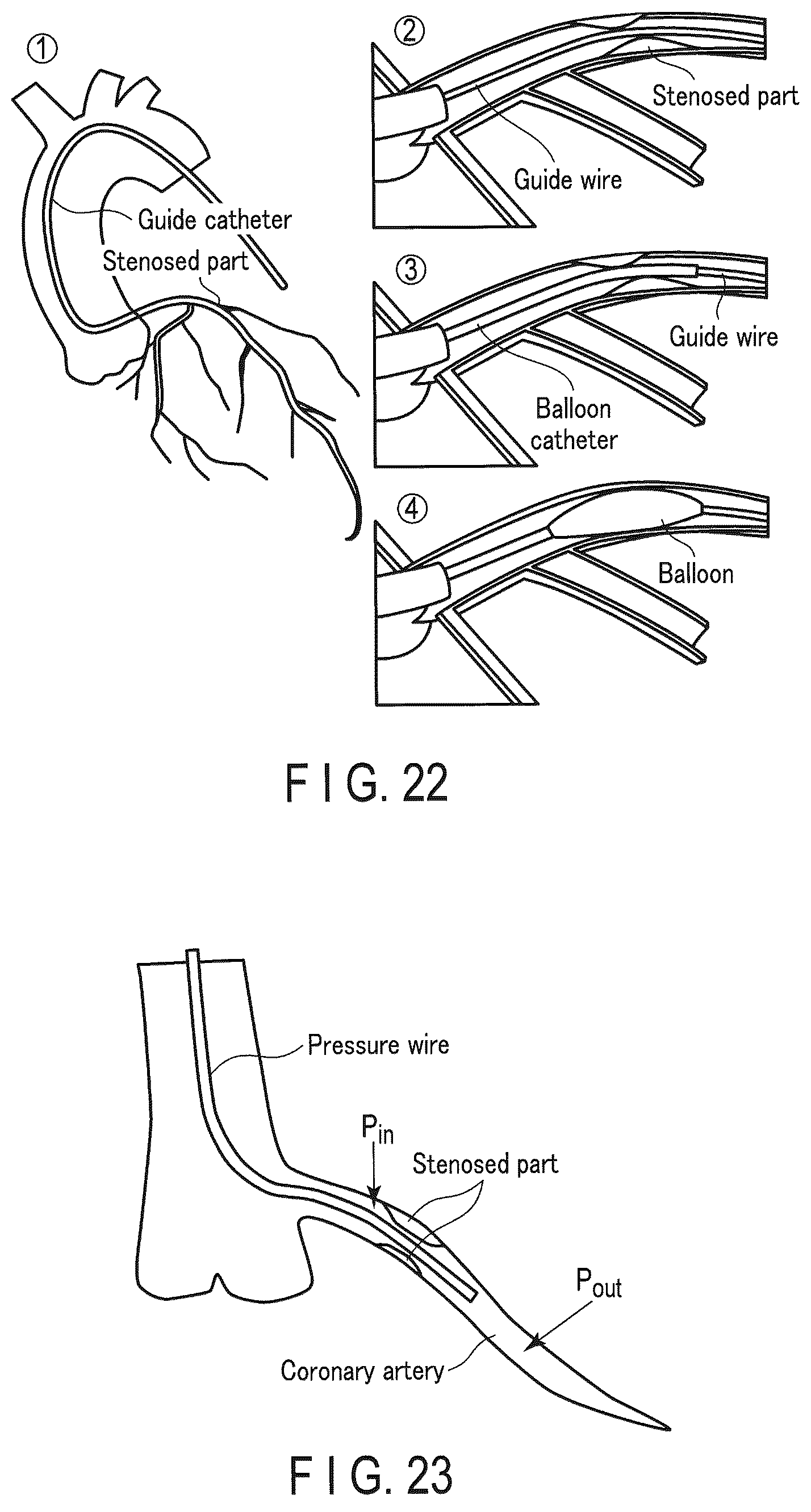 Patent US12437405 Figure 18 – Medical image processing apparatus and medical image processing method