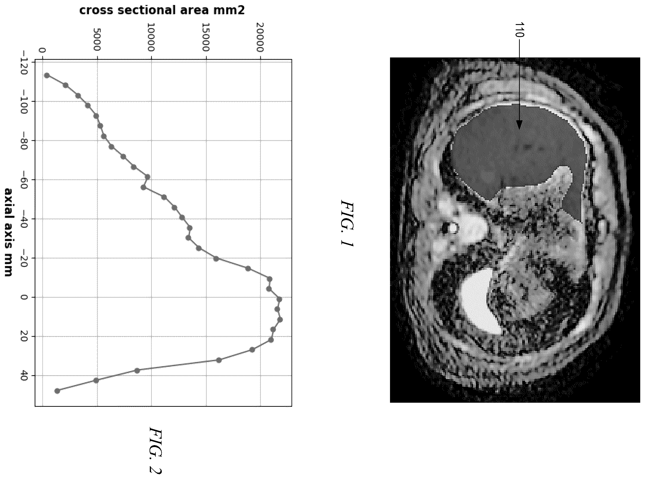 Patent US12437406 Figure 1 – Automated medical image and segmentation quality assessment for machine learning tasks