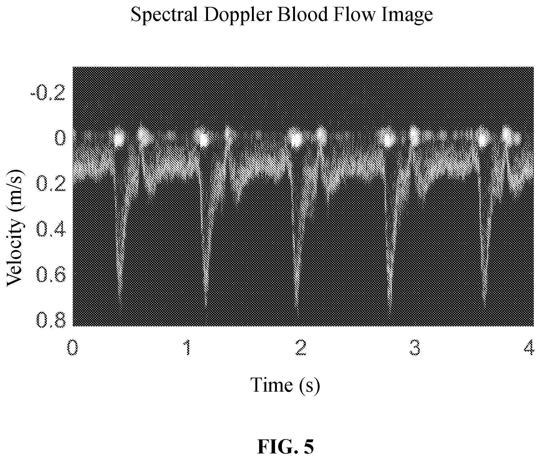 Patent US12437407 Figure 5 – Methods and systems for ultrasound image processing