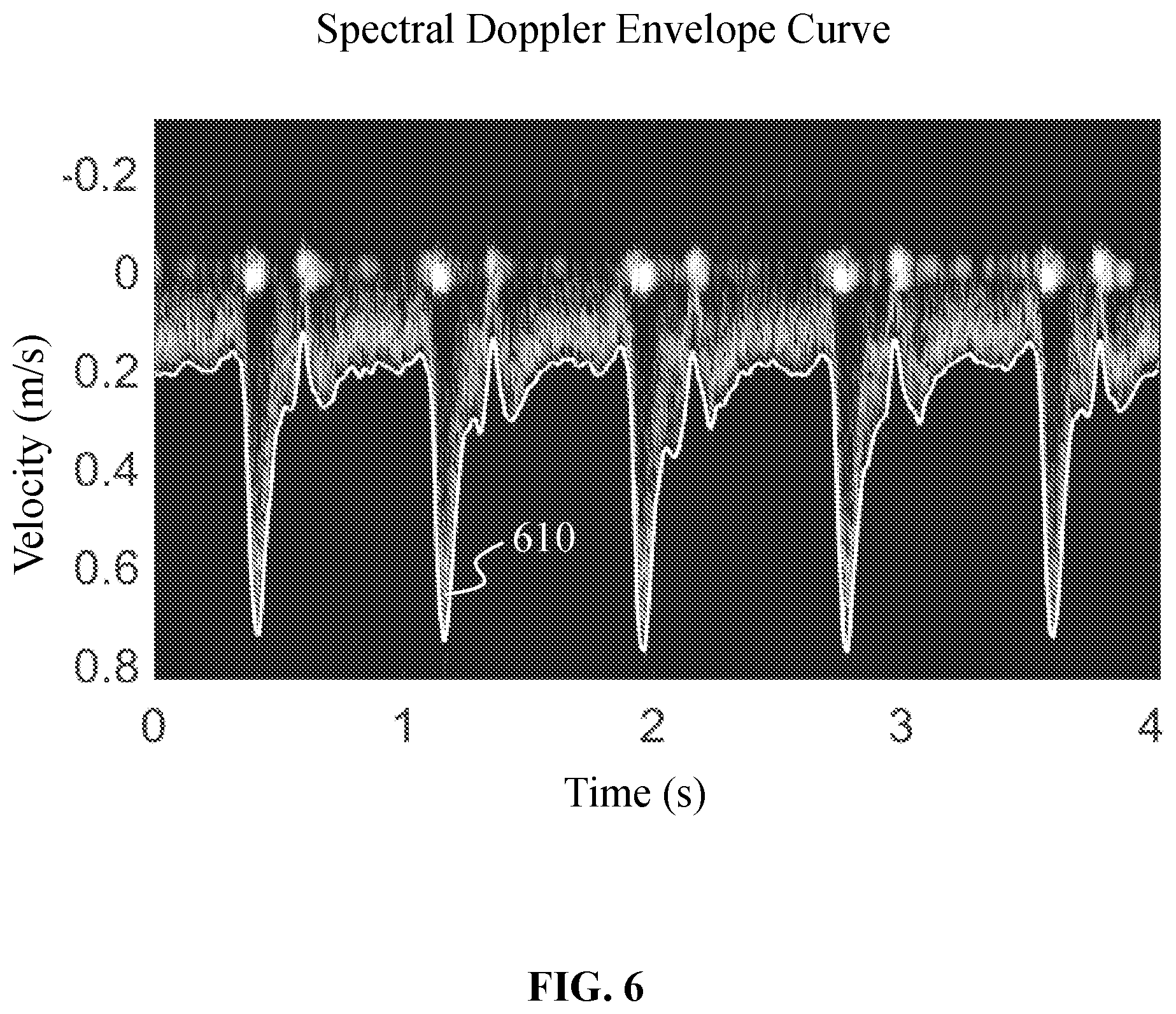 Patent US12437407 Figure 6 – Methods and systems for ultrasound image processing