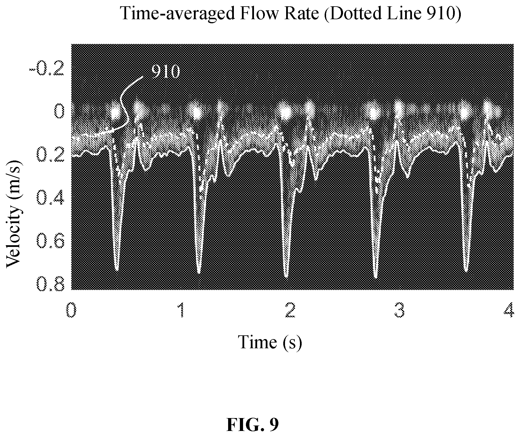 Patent US12437407 Figure 9 – Methods and systems for ultrasound image processing