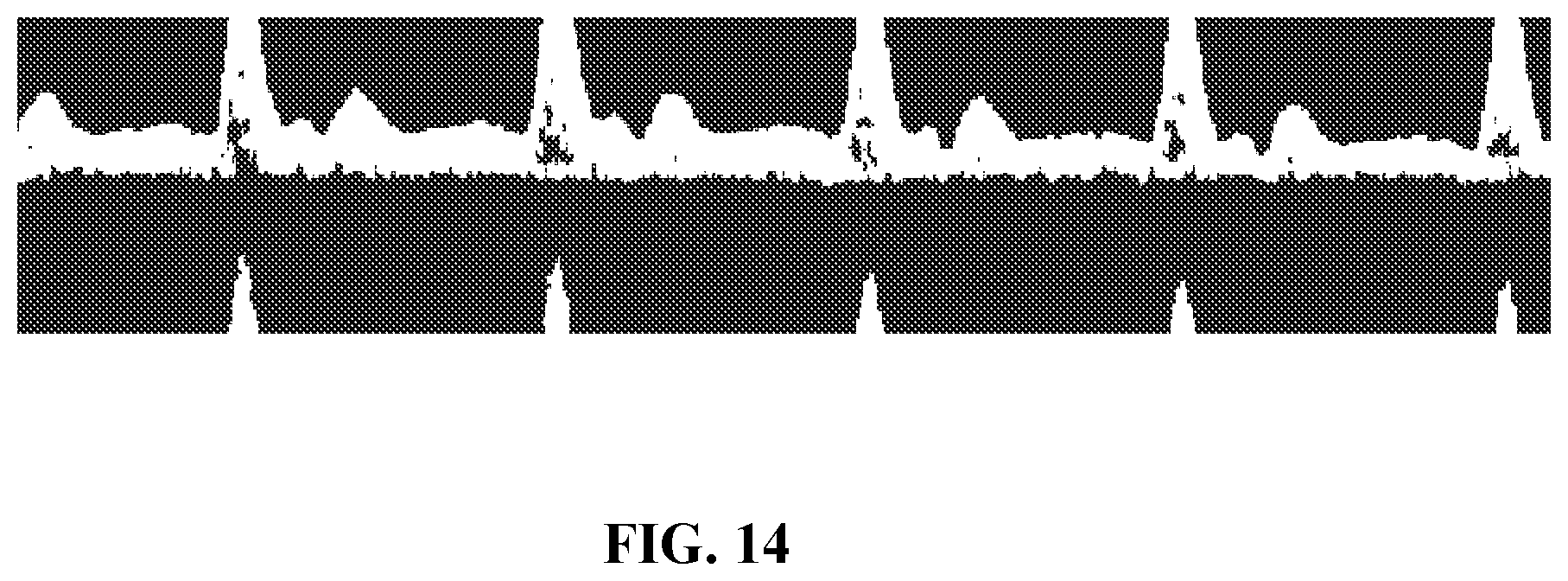 Patent US12437407 Figure 14 – Methods and systems for ultrasound image processing