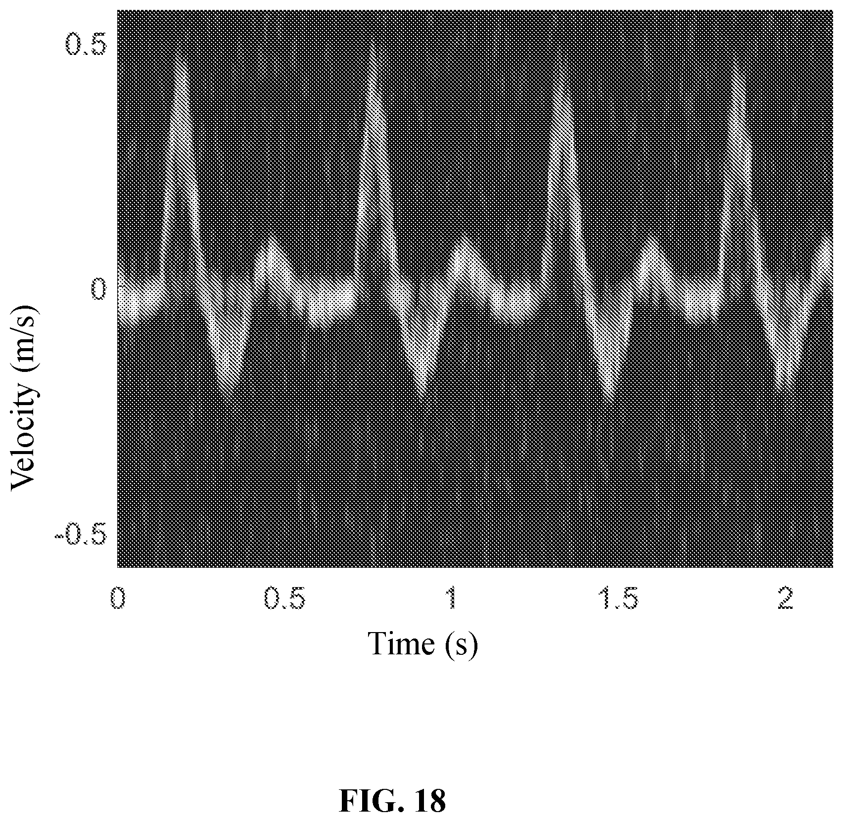 Patent US12437407 Figure 18 – Methods and systems for ultrasound image processing