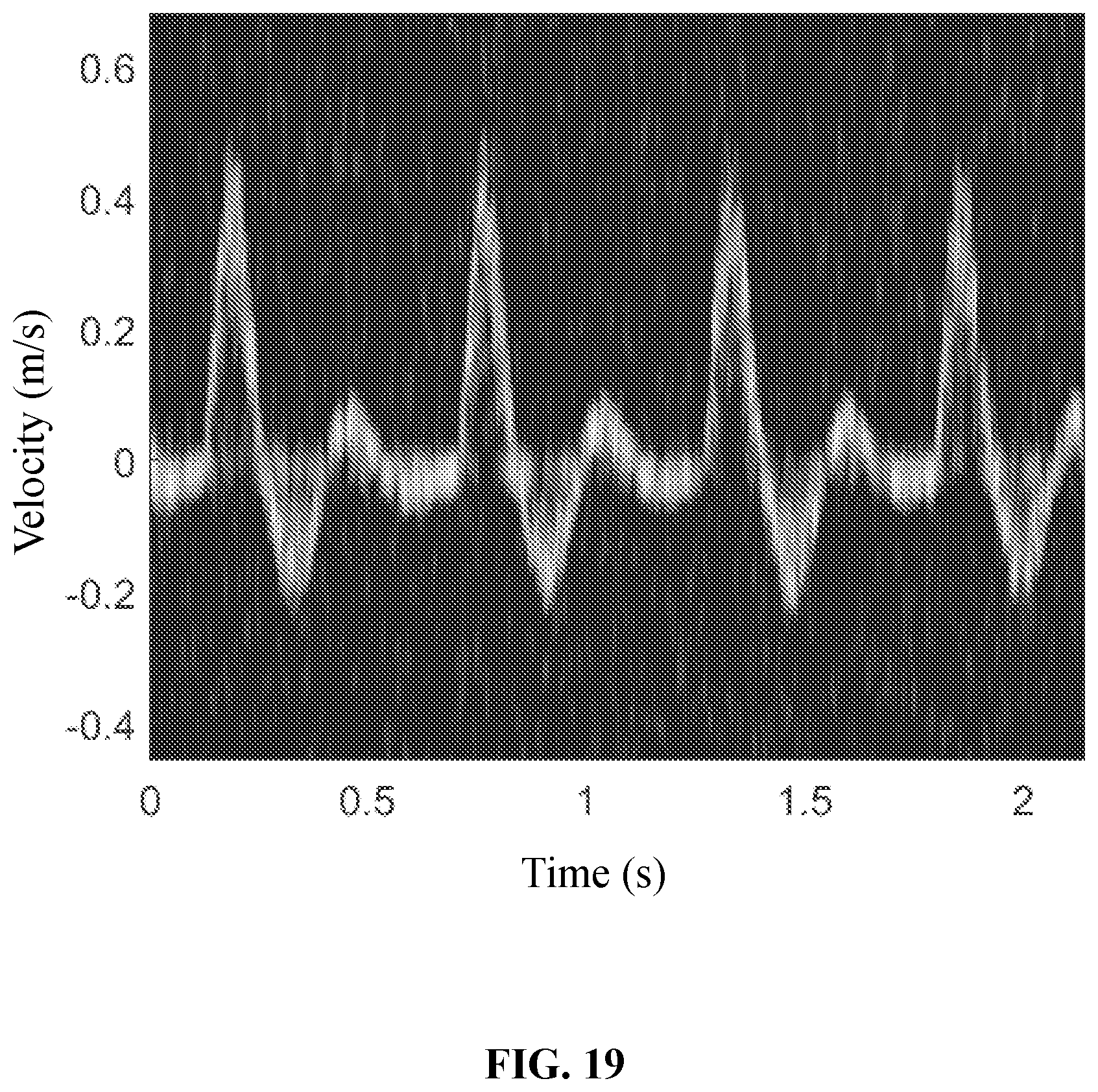 Patent US12437407 Figure 19 – Methods and systems for ultrasound image processing