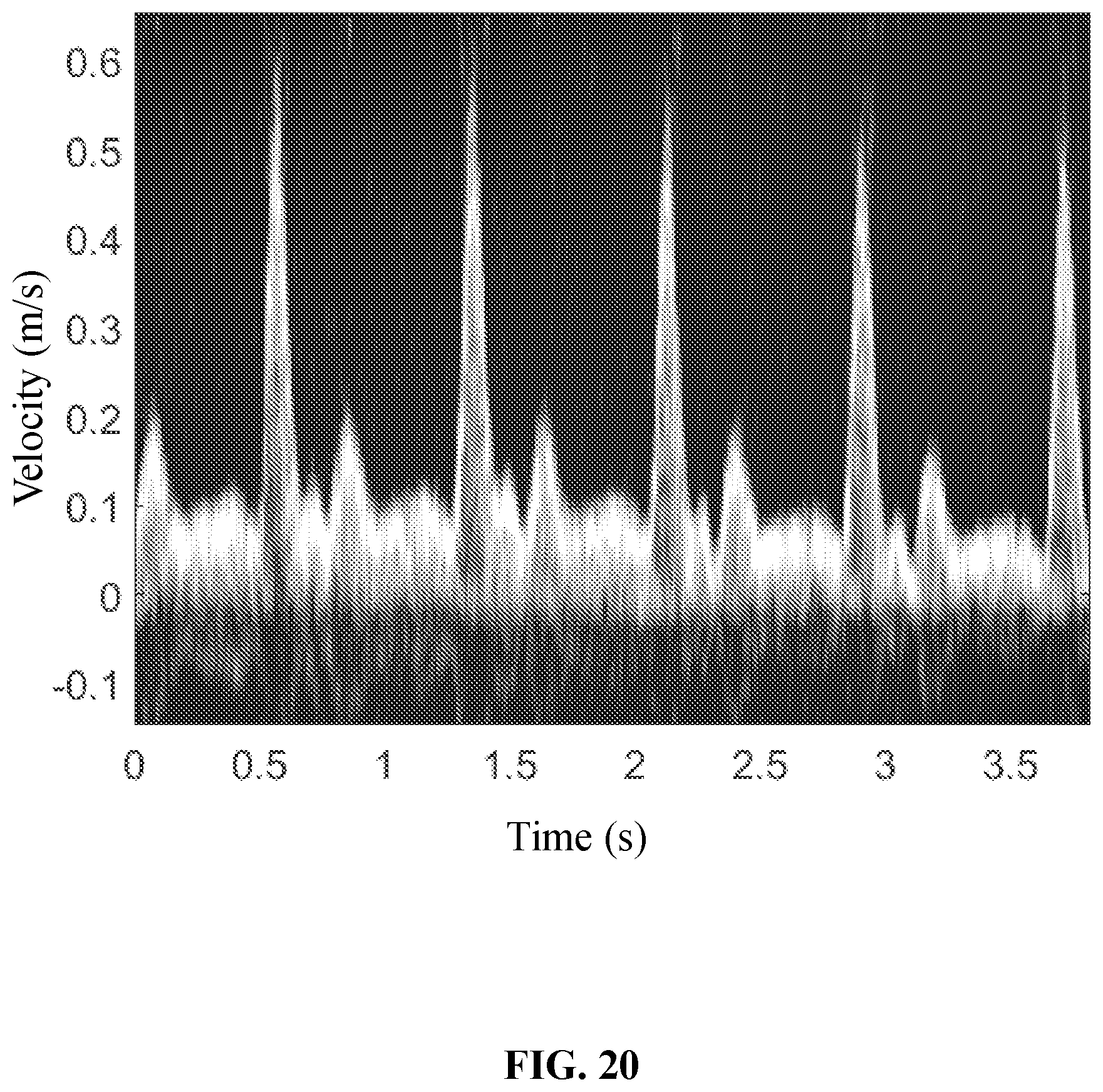 Patent US12437407 Figure 20 – Methods and systems for ultrasound image processing