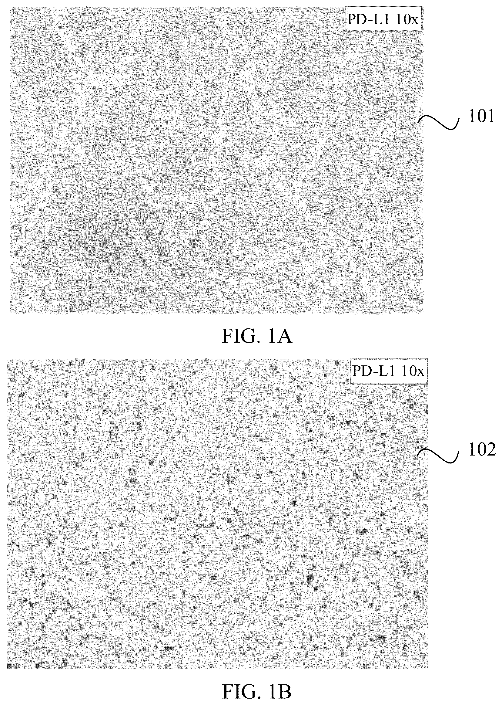 Patent US12437410 Figure 1 – Artificial intelligence-based pathological image processing method and apparatus, electronic device, and storage medium