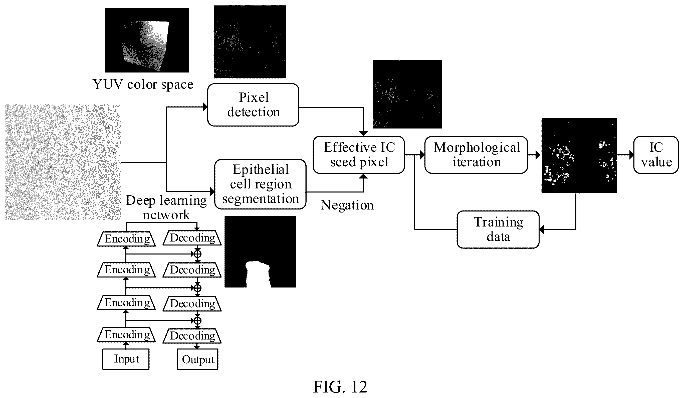 Patent US12437410 Figure 11 – Artificial intelligence-based pathological image processing method and apparatus, electronic device, and storage medium