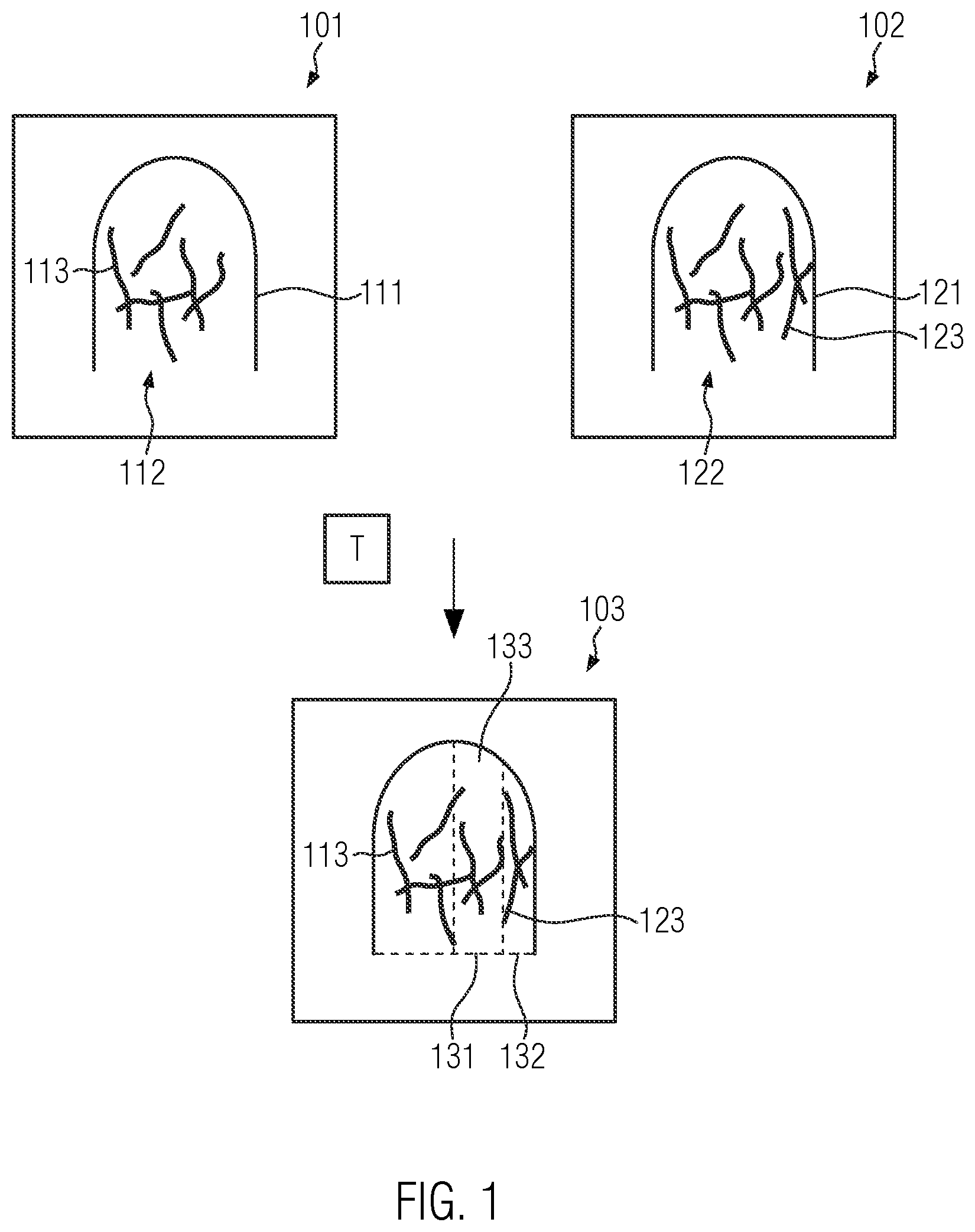 Patent US12437425 Figure 1 – Computer-implemented method for determining an affine transformation