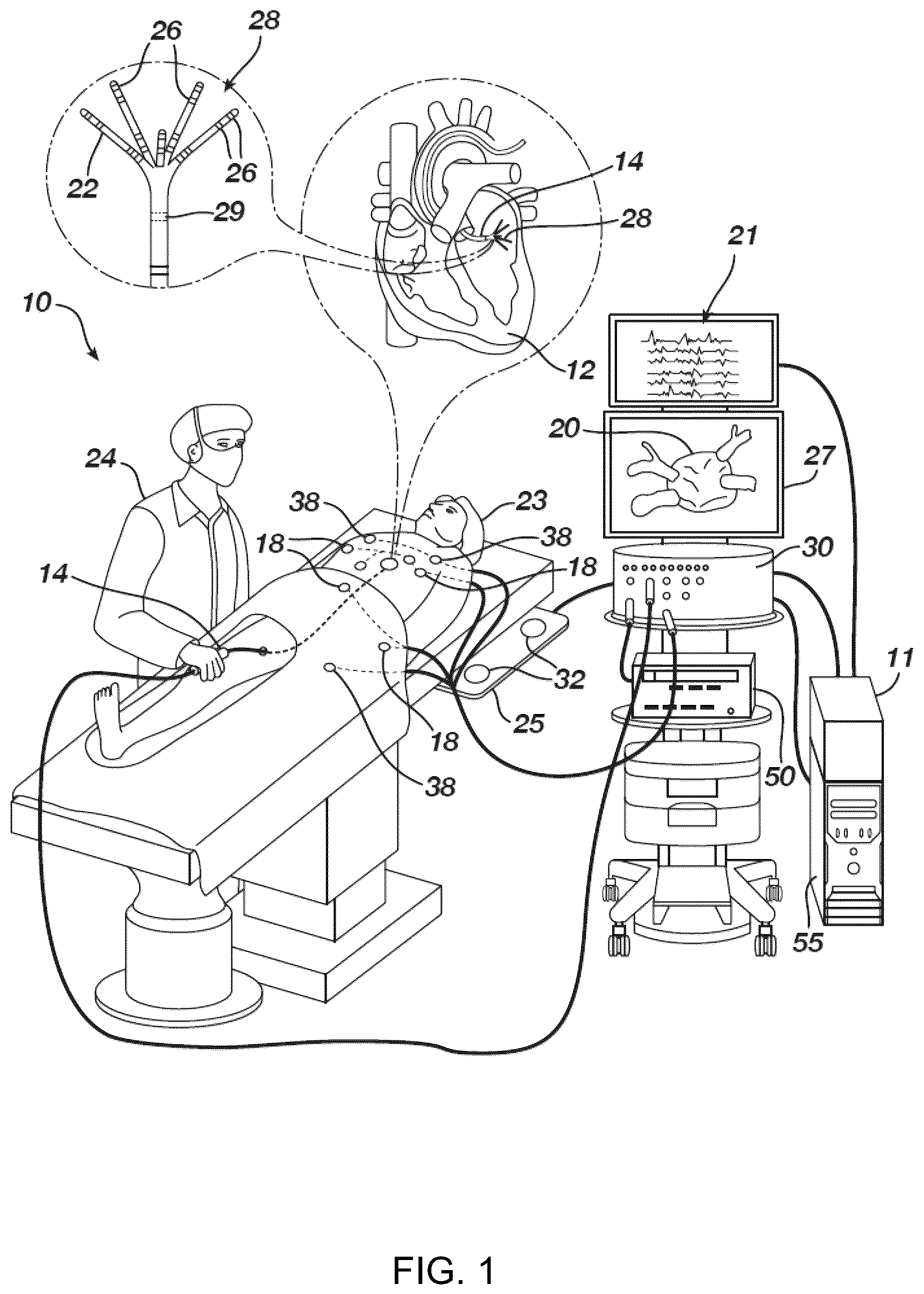 Patent US12437466 Figure 1 – Using signed distance functions to visualize pulsed field ablation (PFA) tags