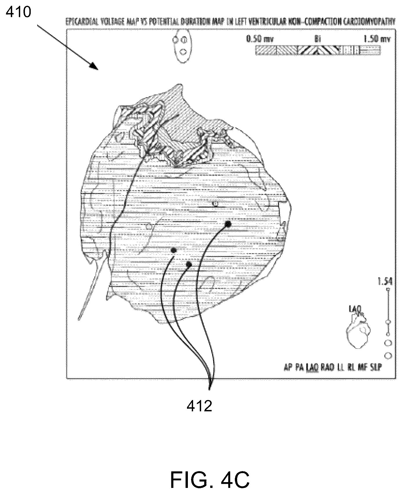 Patent US12437466 Figure 6 – Using signed distance functions to visualize pulsed field ablation (PFA) tags