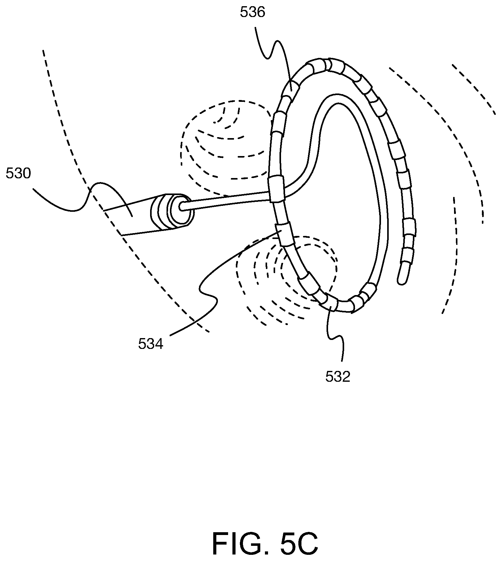 Patent US12437466 Figure 10 – Using signed distance functions to visualize pulsed field ablation (PFA) tags