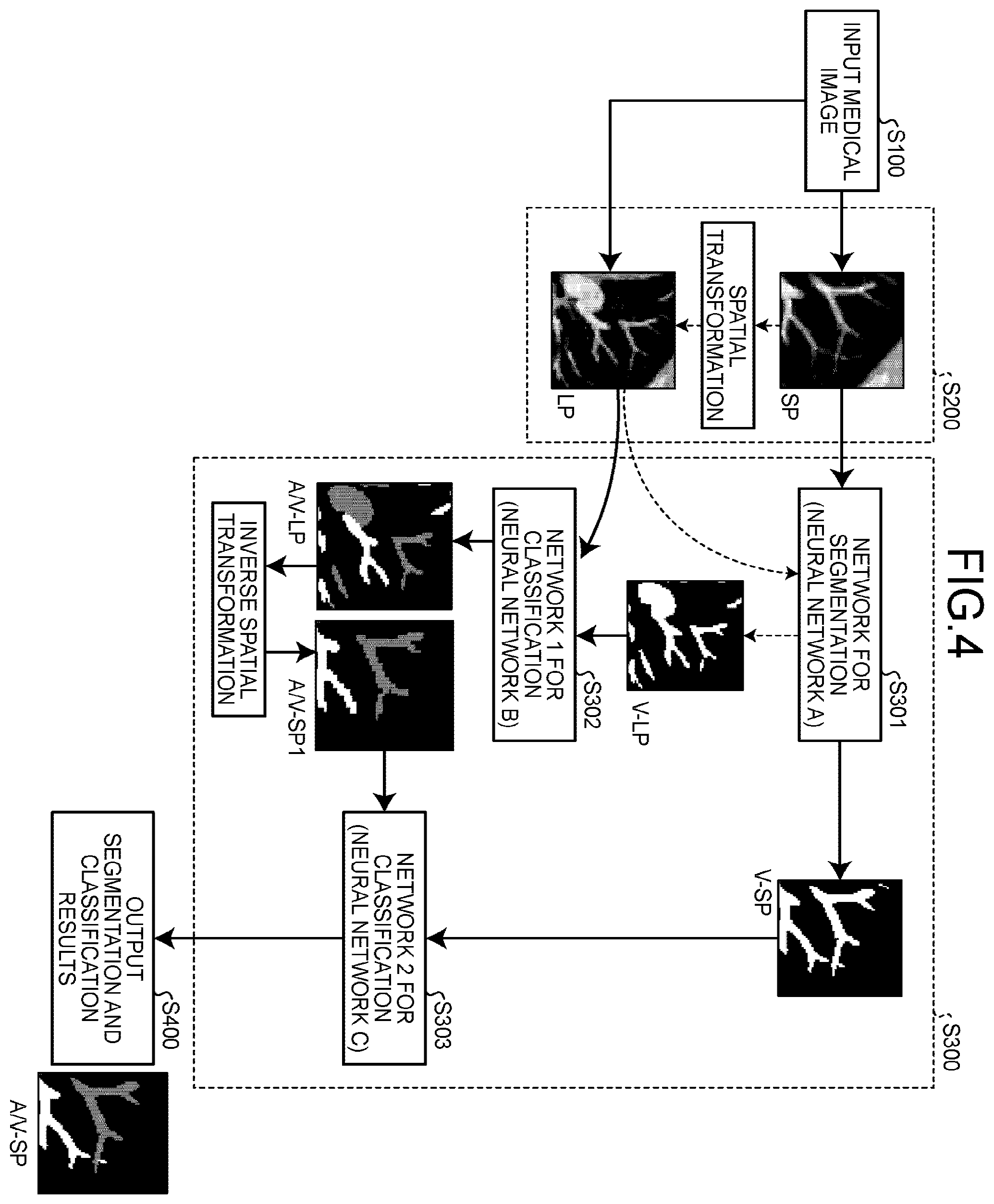 Patent US12437509 Figure 4 – Medical image processing apparatus, method, and storage medium