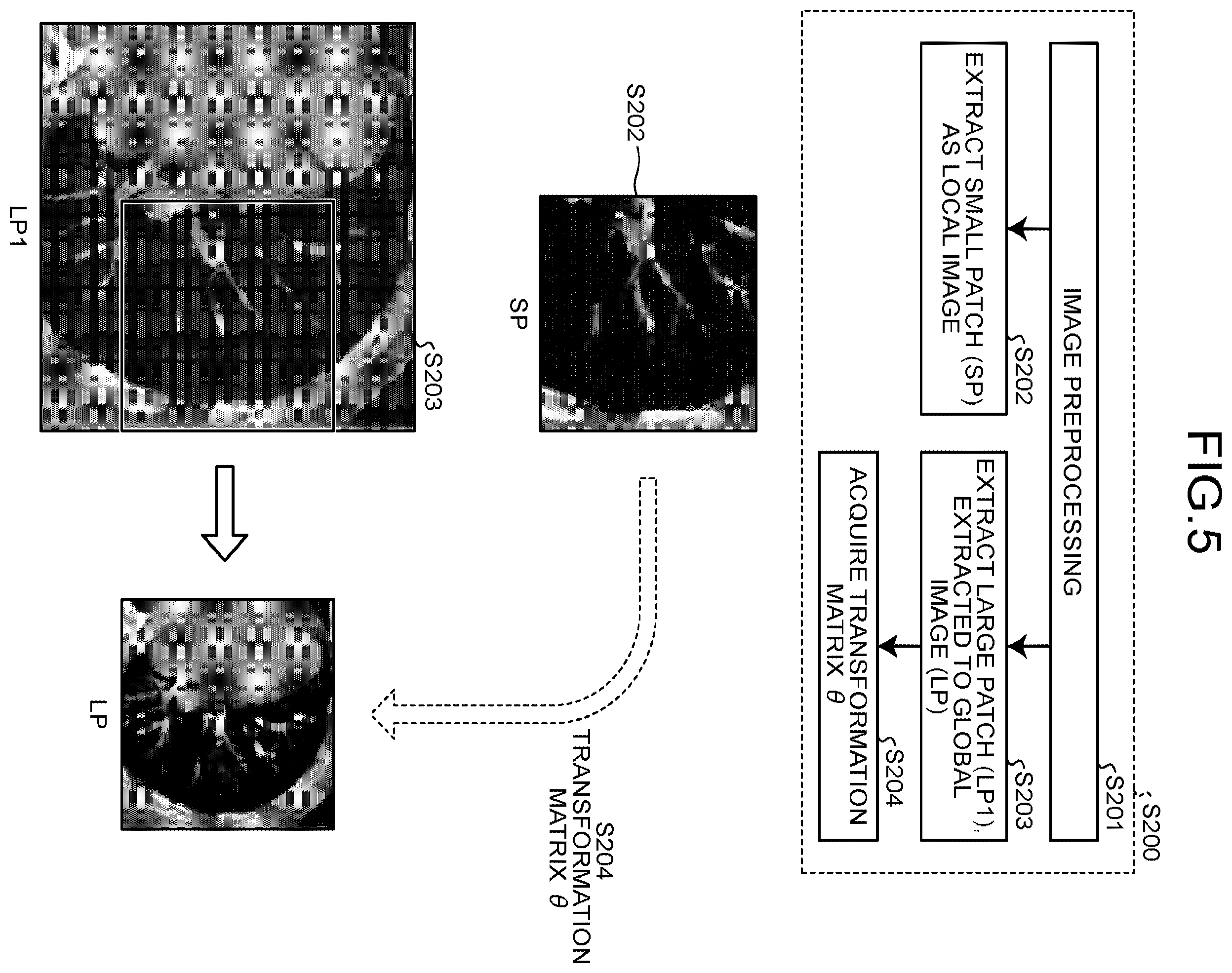 Patent US12437509 Figure 5 – Medical image processing apparatus, method, and storage medium